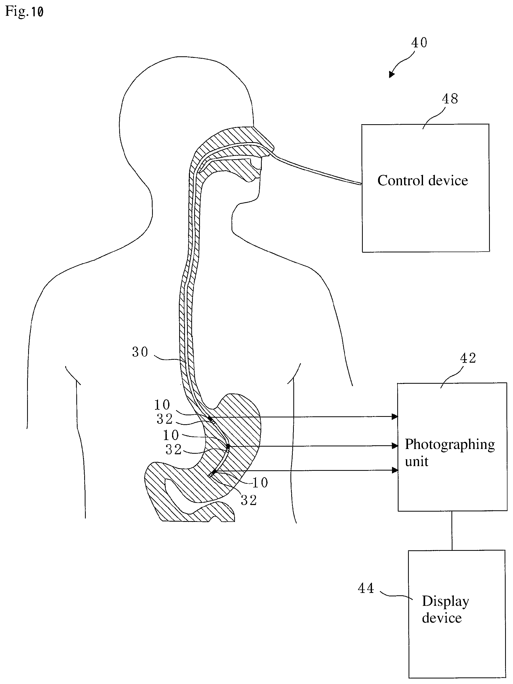 Patent US12310714 Figure 9 – Catheter, guide wire, opening position identification device, opening position identification method, internal object presence determination assistance device, diagnostic assistance device, and treatment assistance device