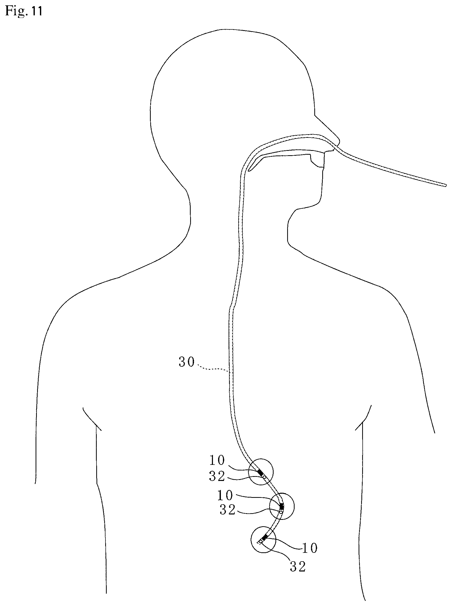 Patent US12310714 Figure 10 – Catheter, guide wire, opening position identification device, opening position identification method, internal object presence determination assistance device, diagnostic assistance device, and treatment assistance device