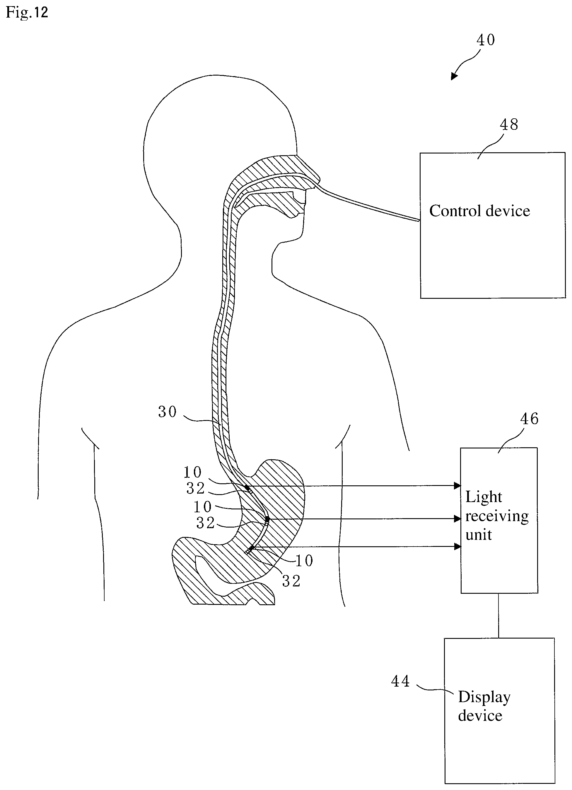 Patent US12310714 Figure 11 – Catheter, guide wire, opening position identification device, opening position identification method, internal object presence determination assistance device, diagnostic assistance device, and treatment assistance device