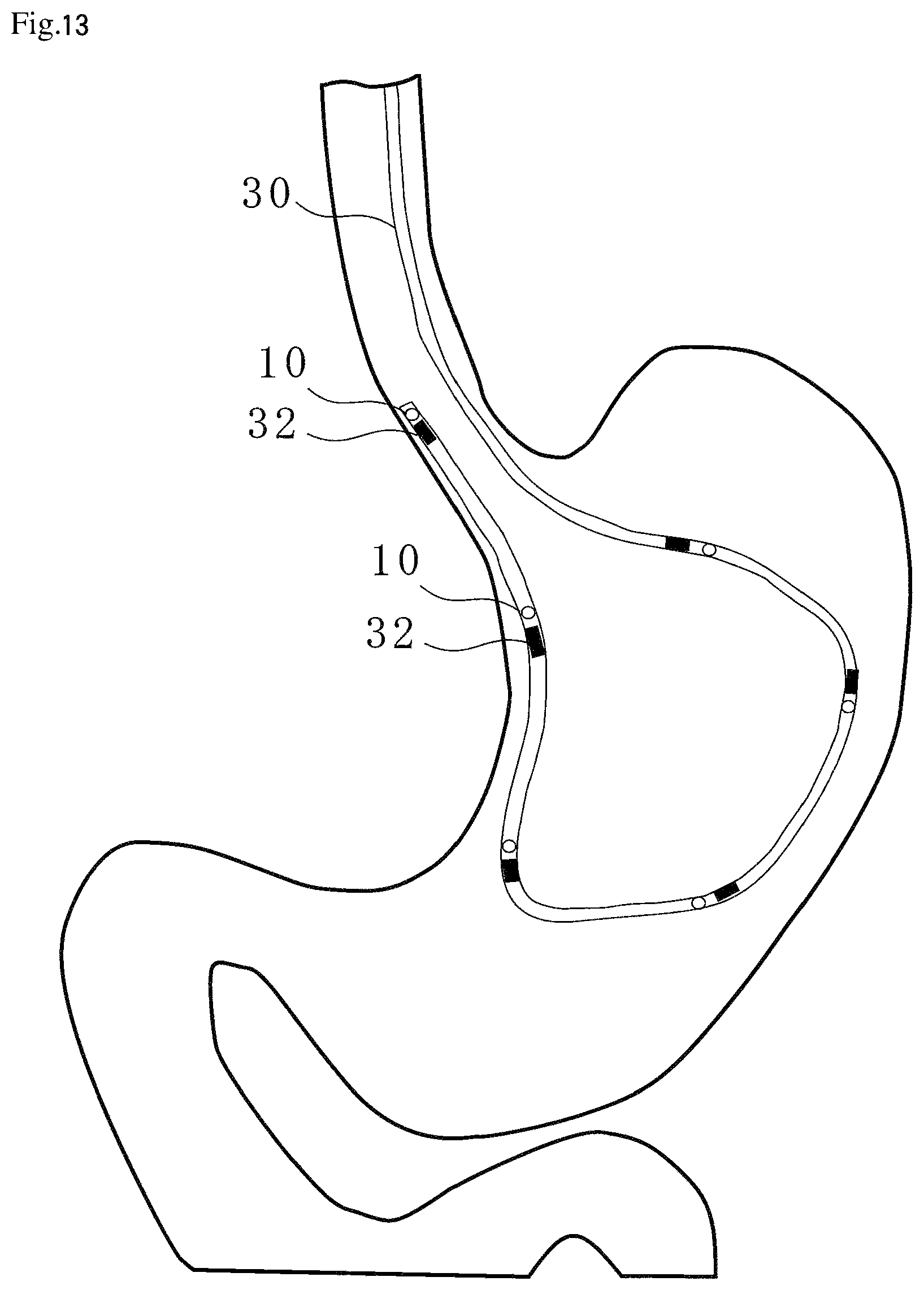 Patent US12310714 Figure 12 – Catheter, guide wire, opening position identification device, opening position identification method, internal object presence determination assistance device, diagnostic assistance device, and treatment assistance device