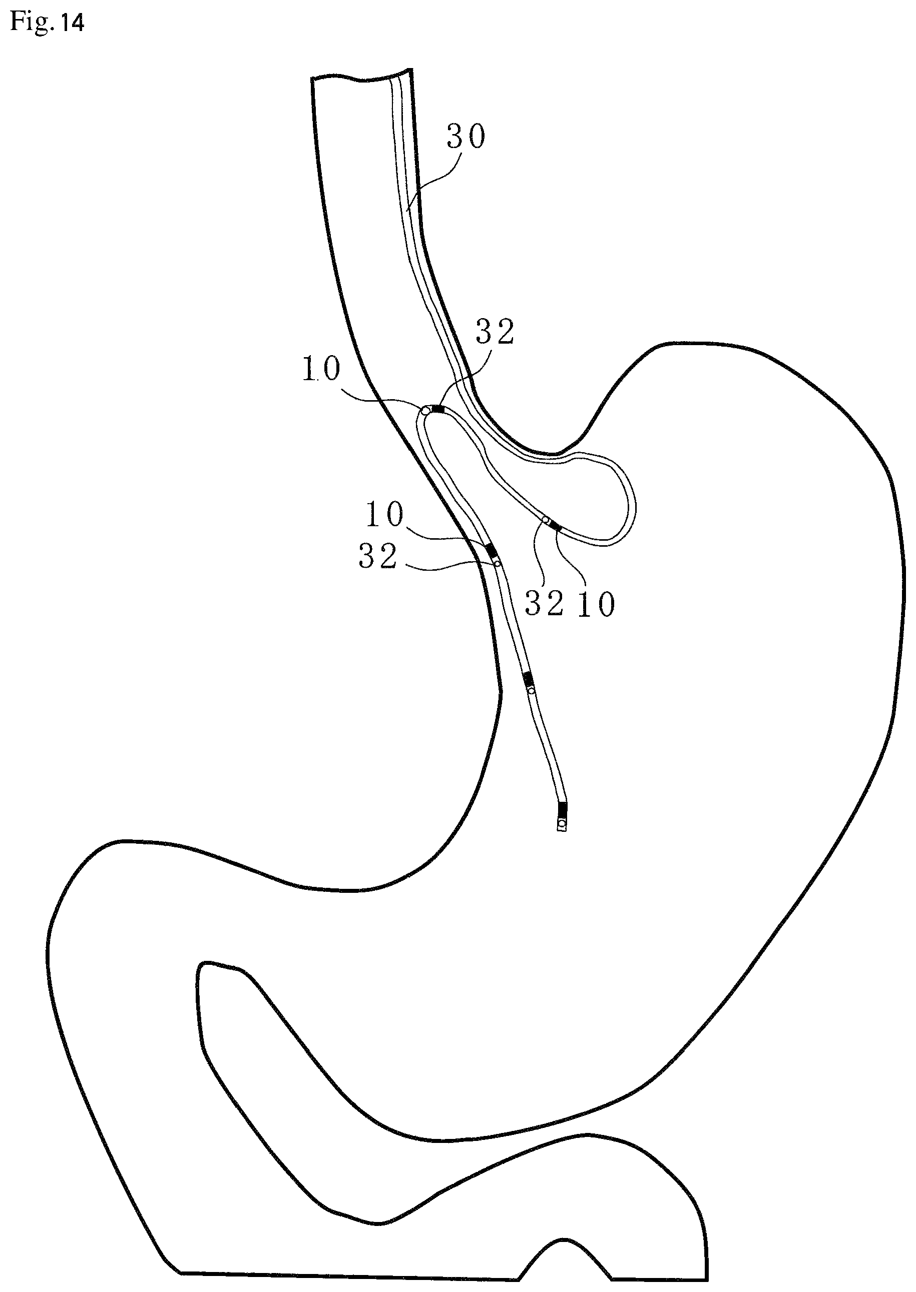 Patent US12310714 Figure 13 – Catheter, guide wire, opening position identification device, opening position identification method, internal object presence determination assistance device, diagnostic assistance device, and treatment assistance device