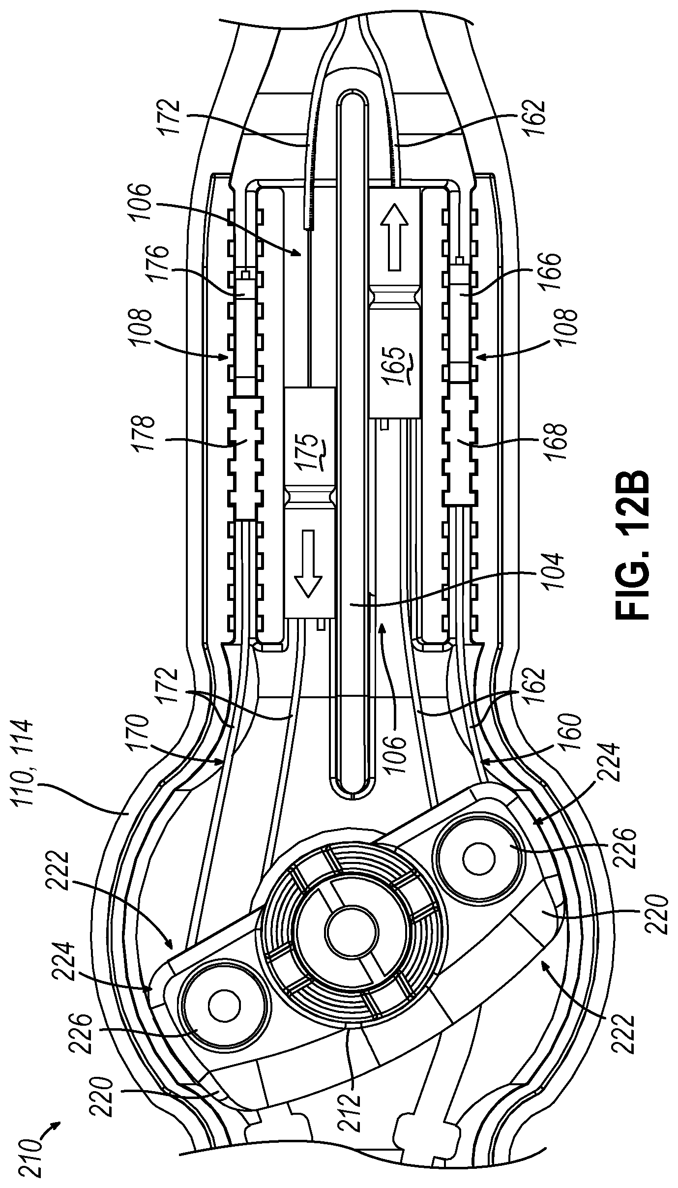 Patent US12310715 Figure 14 – Catheter deflection system with deflection load limiter