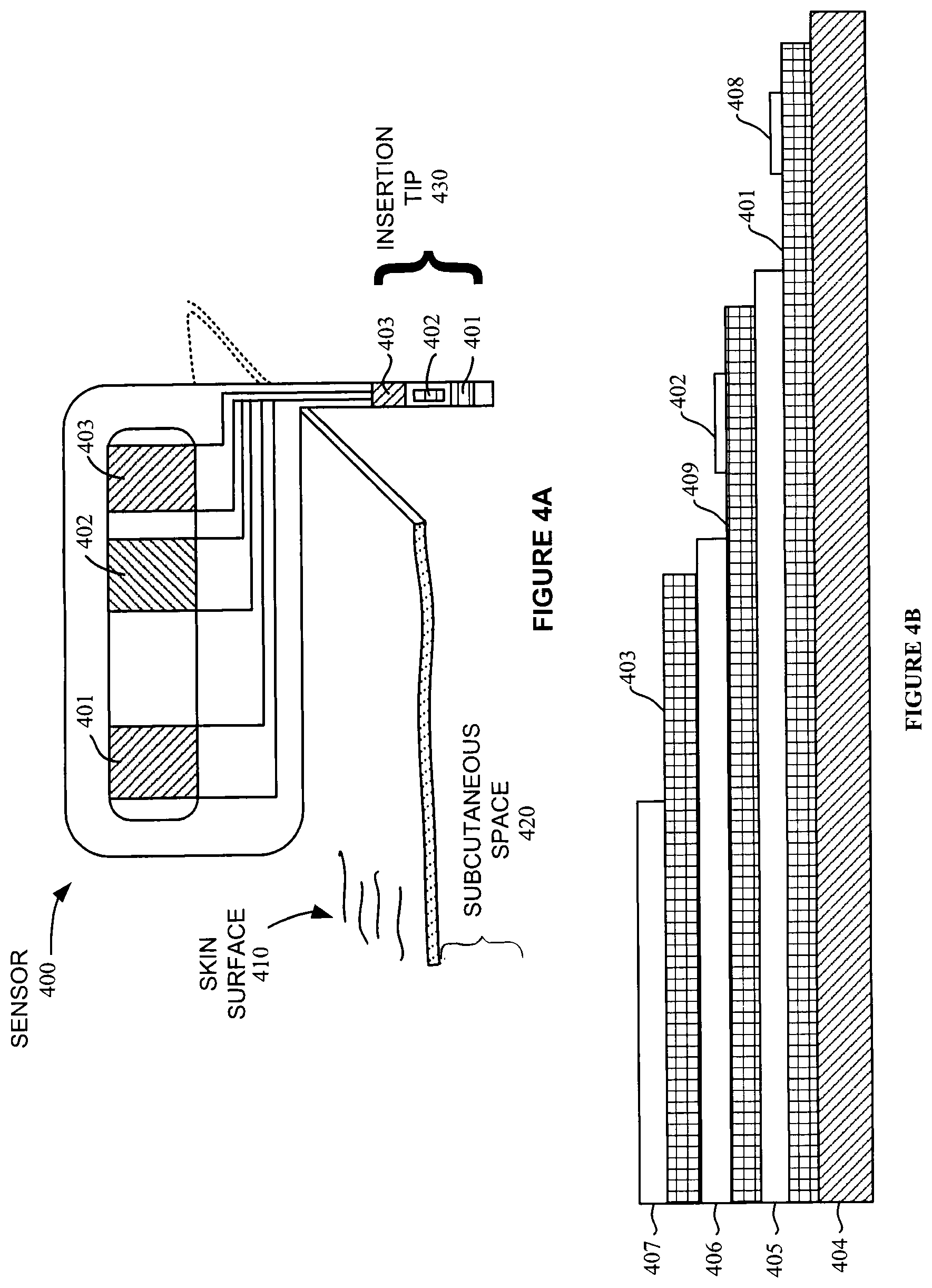Patent US12310721 Figure 4 – Method and apparatus for providing data processing and control in medical communication system