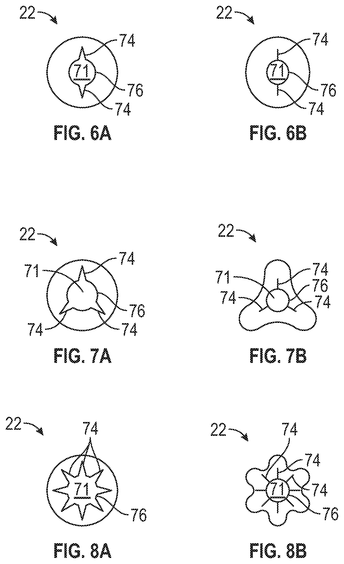 Patent US12310729 Figure 11 – Blood collection system with automatic pressure management and related methods