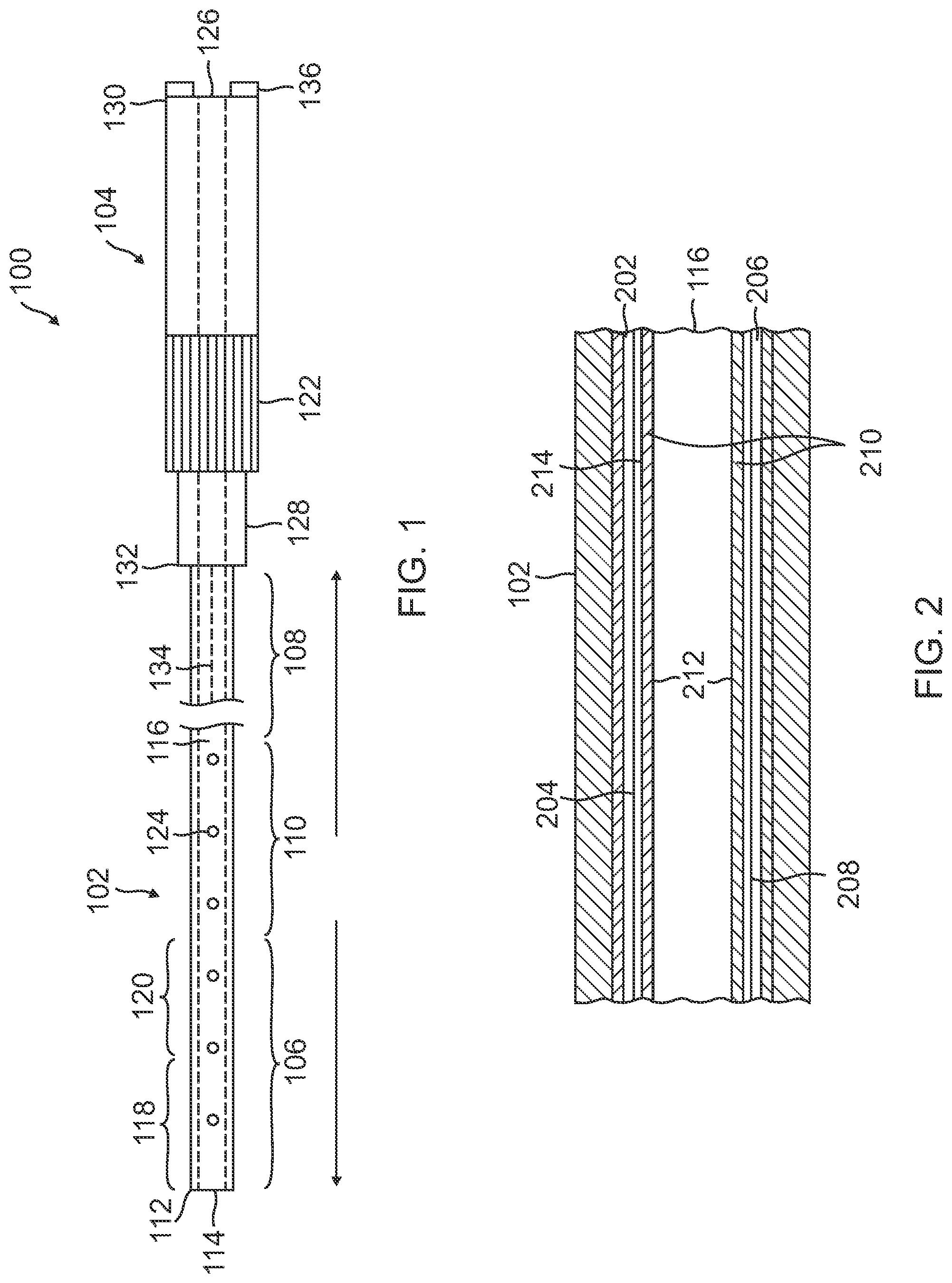 Patent US12310733 Figure 1 – Intrauterine access catheter for delivering and facilitating operation of a medical apparatus for assisting parturition