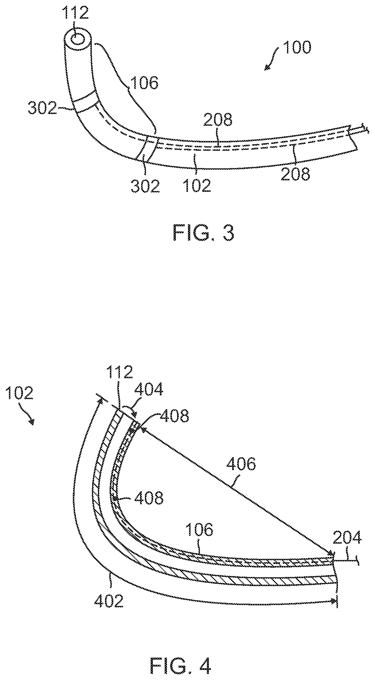 Patent US12310733 Figure 2 – Intrauterine access catheter for delivering and facilitating operation of a medical apparatus for assisting parturition