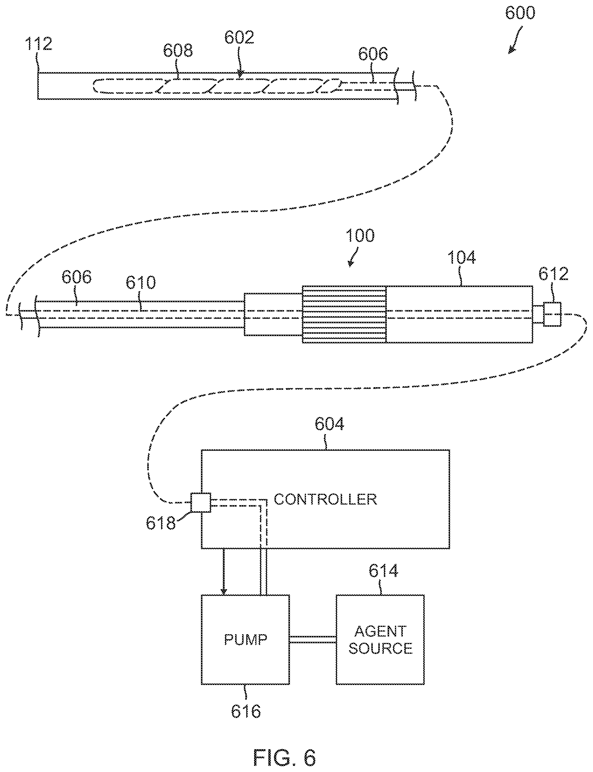 Patent US12310733 Figure 4 – Intrauterine access catheter for delivering and facilitating operation of a medical apparatus for assisting parturition