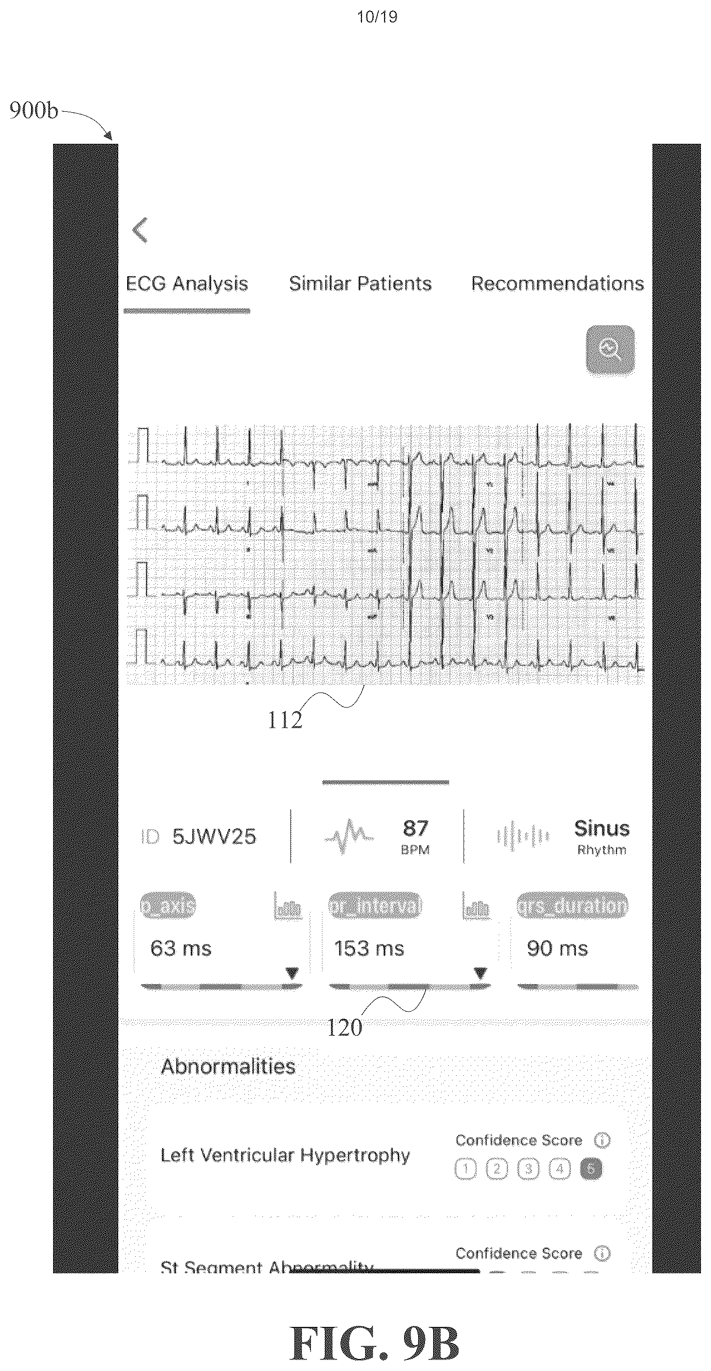 Patent US12310736 Figure 10 – Apparatus and methods for identifying abnormal biomedical features within images of biomedical data