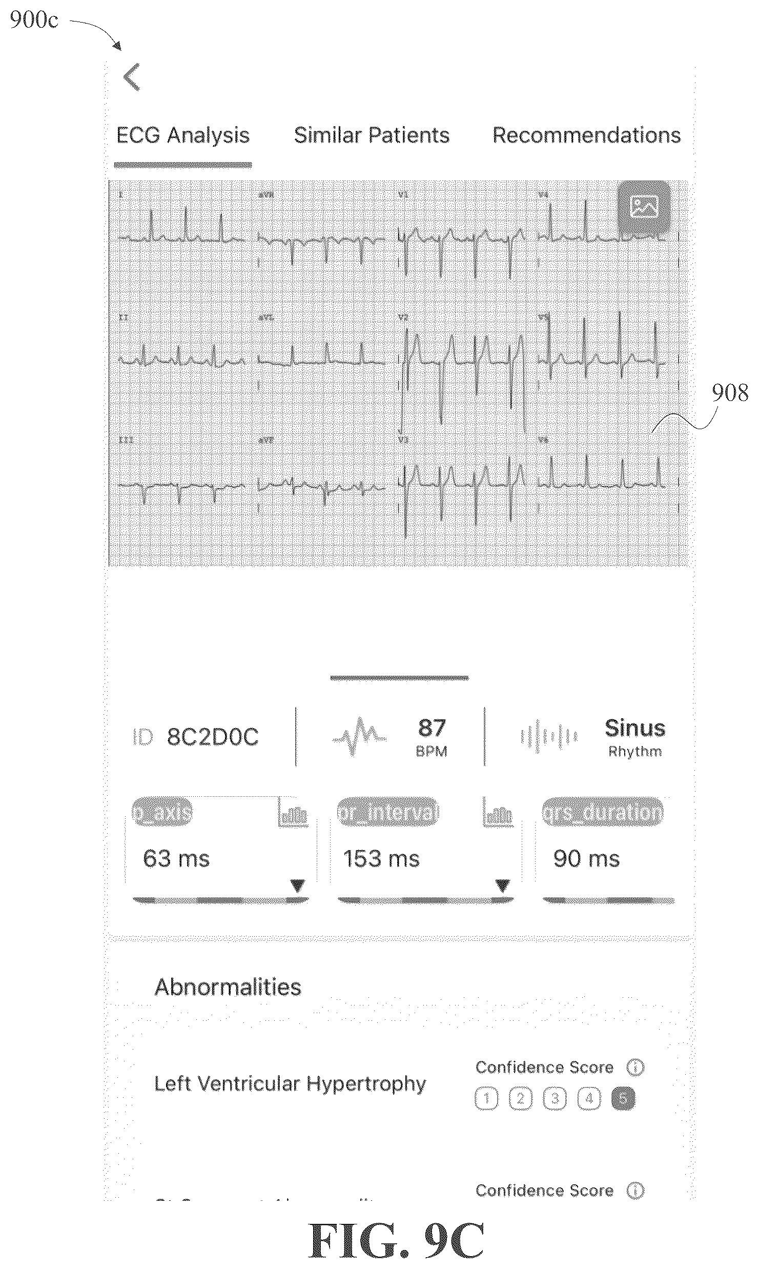 Patent US12310736 Figure 11 – Apparatus and methods for identifying abnormal biomedical features within images of biomedical data