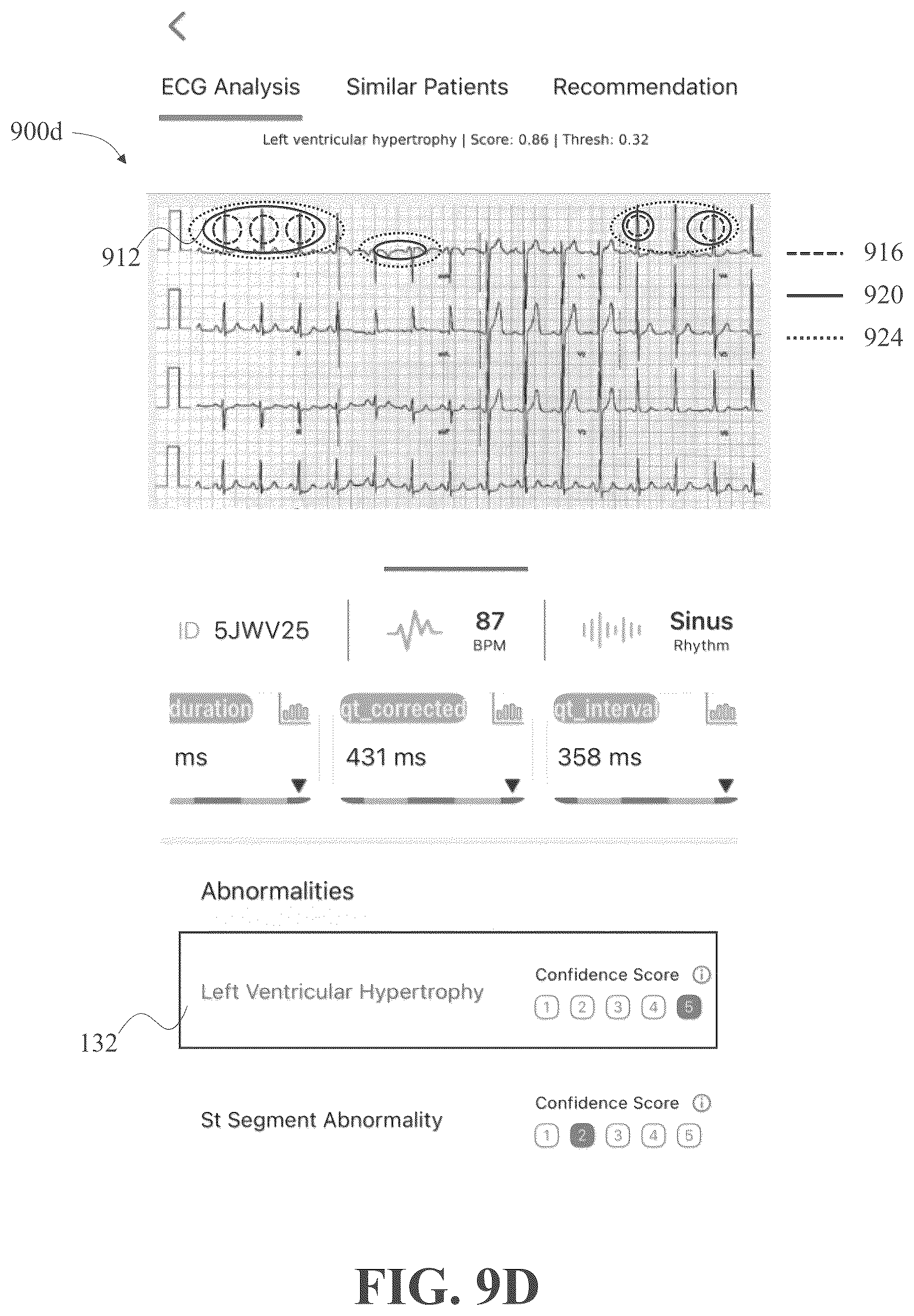 Patent US12310736 Figure 12 – Apparatus and methods for identifying abnormal biomedical features within images of biomedical data