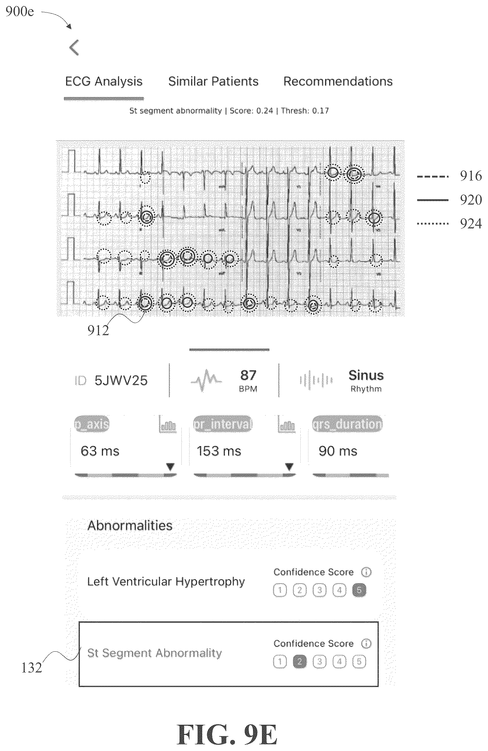 Patent US12310736 Figure 13 – Apparatus and methods for identifying abnormal biomedical features within images of biomedical data