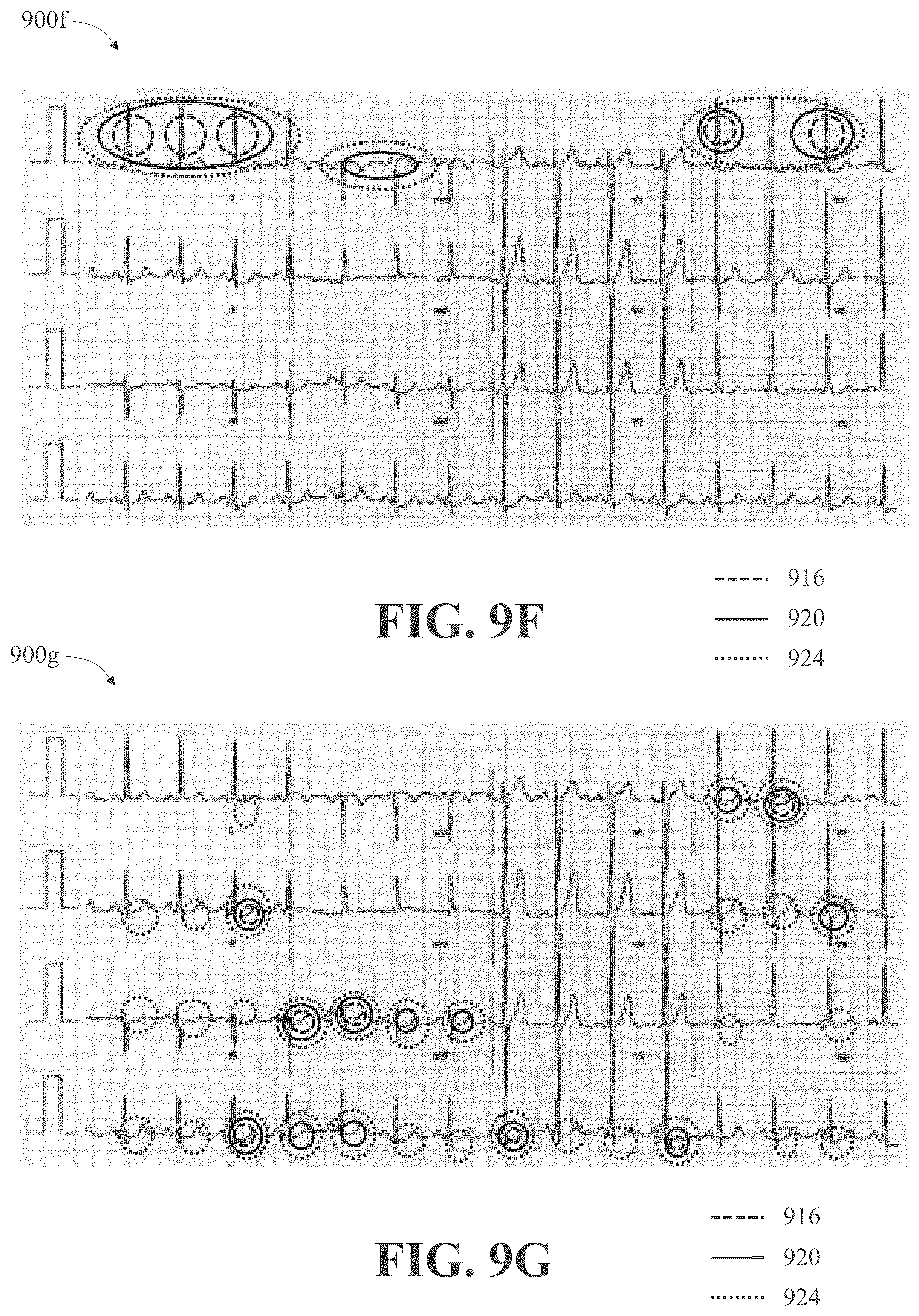Patent US12310736 Figure 14 – Apparatus and methods for identifying abnormal biomedical features within images of biomedical data