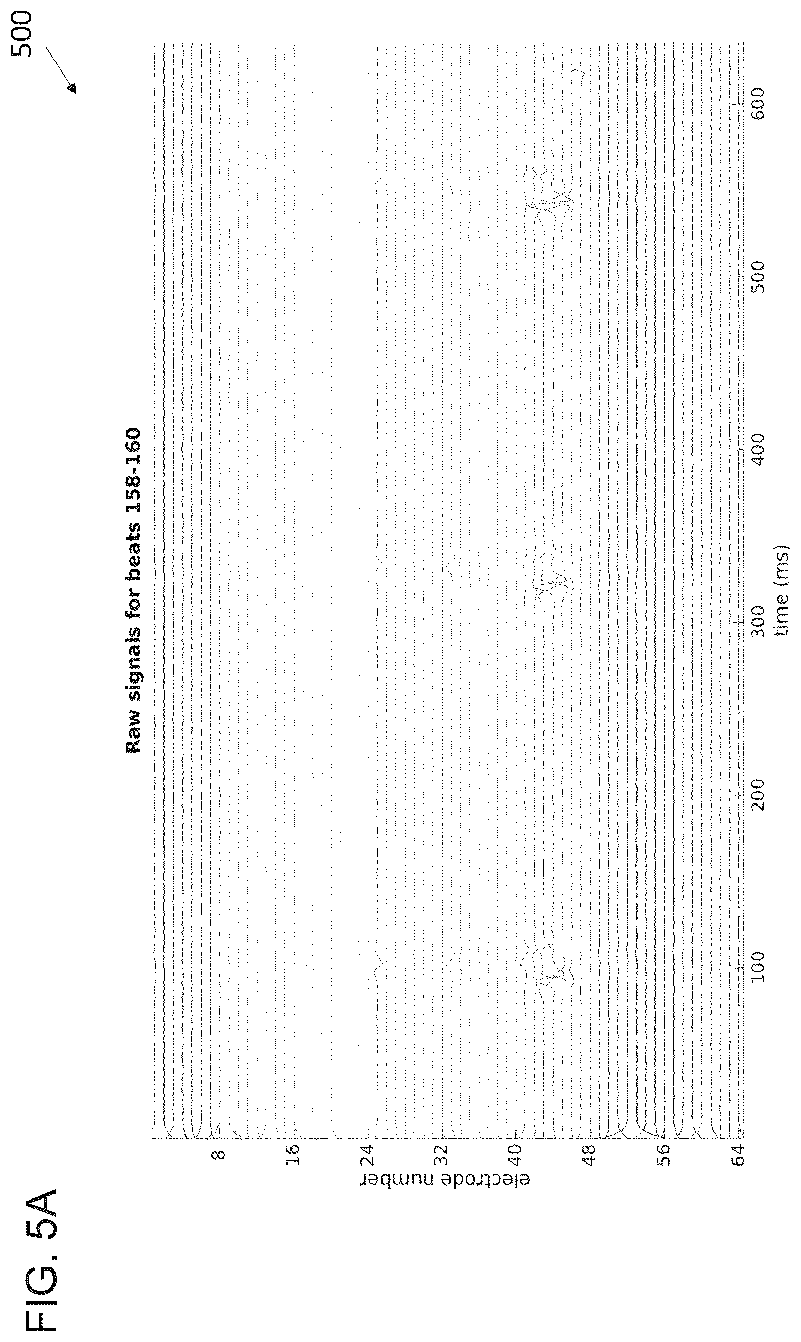 Patent US12310737 Figure 8 – Interactive 2D scatter plot of EGM characteristic metrics