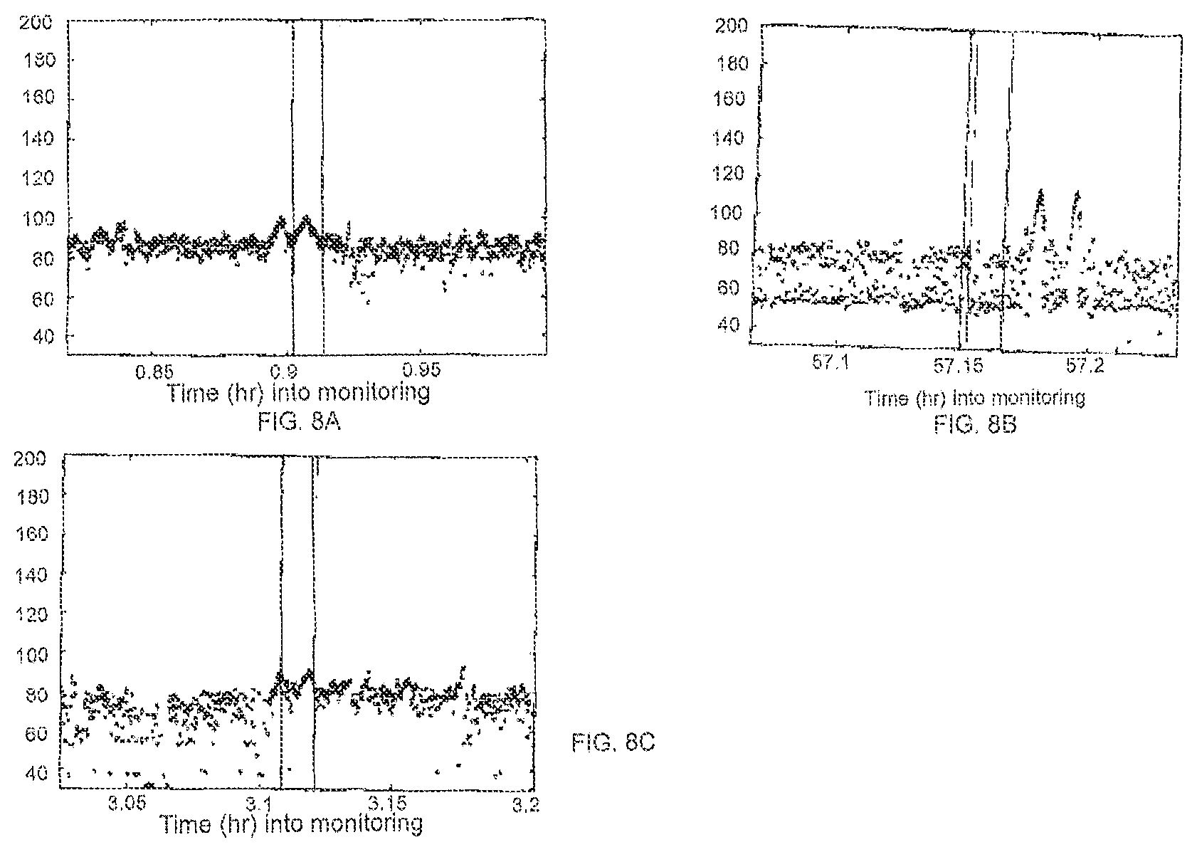 Patent US12310740 Figure 10 – Detecting or validating a detection of a state change from a template of heart rate derivative shape or heart beat wave complex