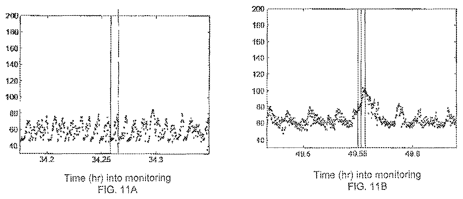 Patent US12310740 Figure 13 – Detecting or validating a detection of a state change from a template of heart rate derivative shape or heart beat wave complex