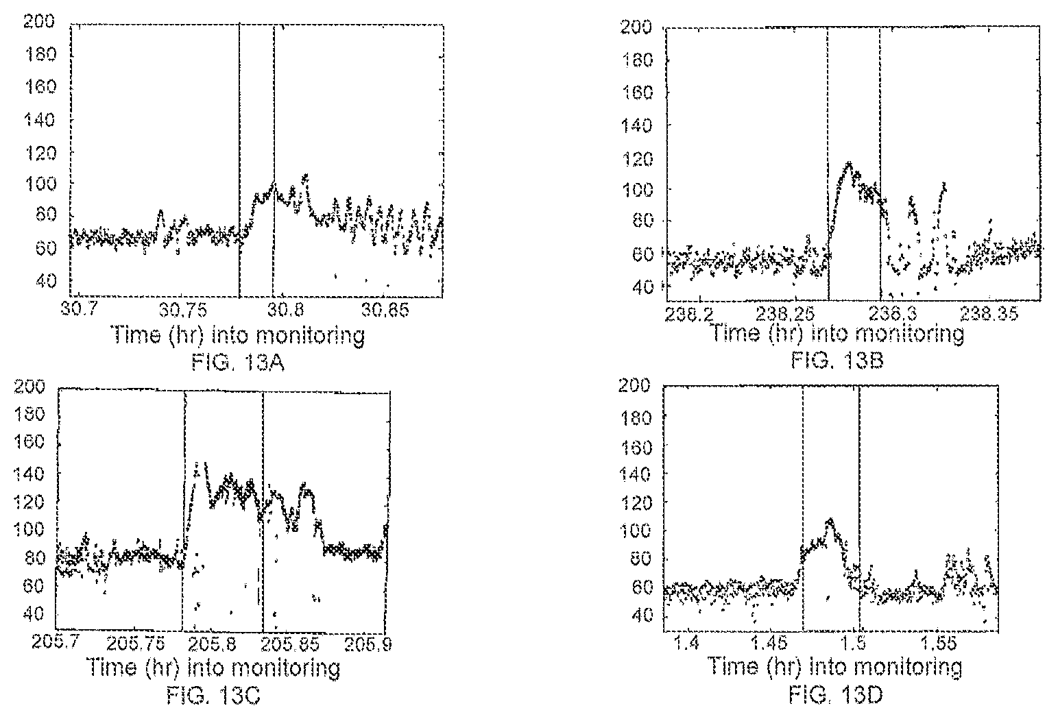 Patent US12310740 Figure 15 – Detecting or validating a detection of a state change from a template of heart rate derivative shape or heart beat wave complex