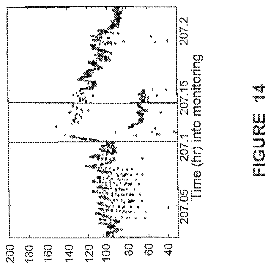 Patent US12310740 Figure 16 – Detecting or validating a detection of a state change from a template of heart rate derivative shape or heart beat wave complex