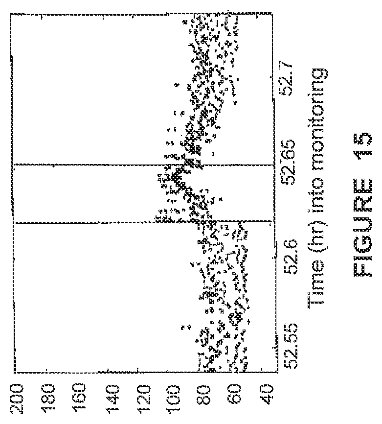 Patent US12310740 Figure 17 – Detecting or validating a detection of a state change from a template of heart rate derivative shape or heart beat wave complex