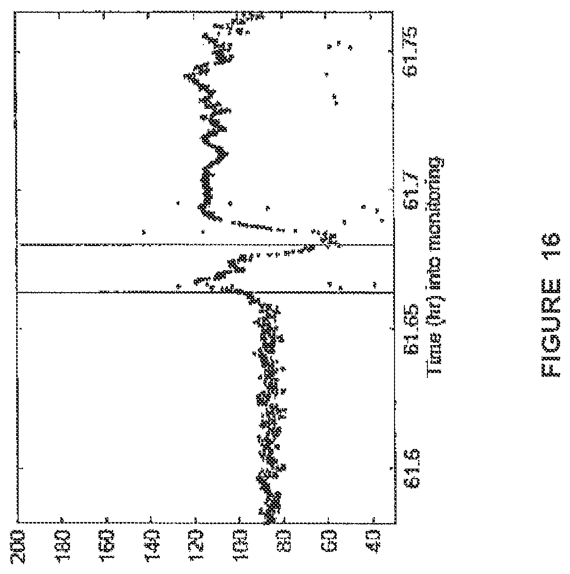 Patent US12310740 Figure 18 – Detecting or validating a detection of a state change from a template of heart rate derivative shape or heart beat wave complex