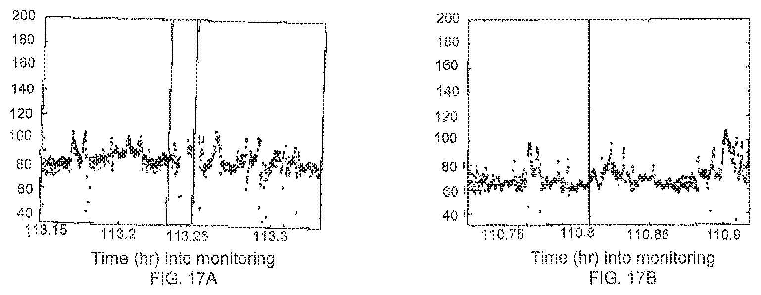 Patent US12310740 Figure 19 – Detecting or validating a detection of a state change from a template of heart rate derivative shape or heart beat wave complex