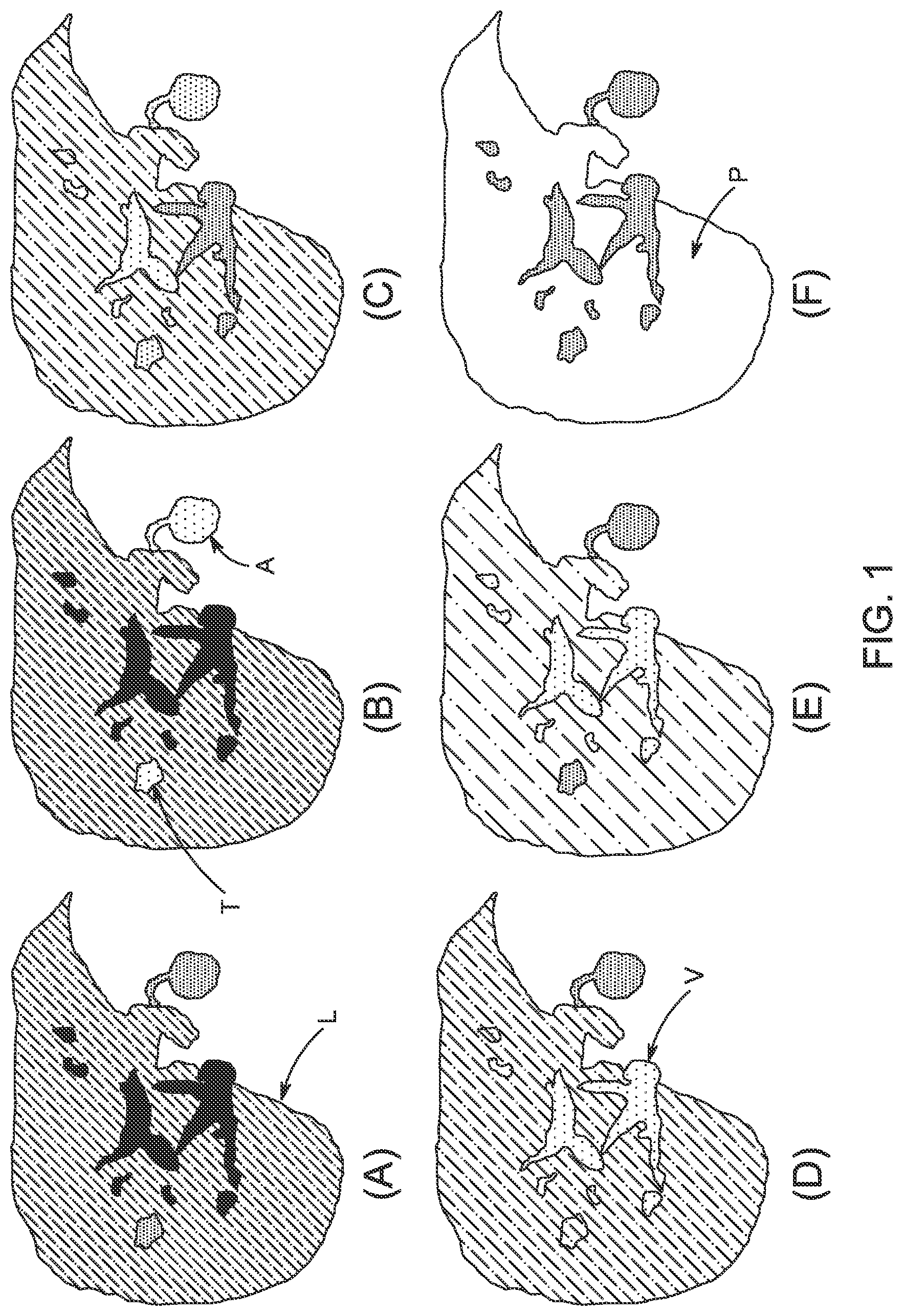 Patent US12310741 Figure 1 – Generation of MRI images of the liver