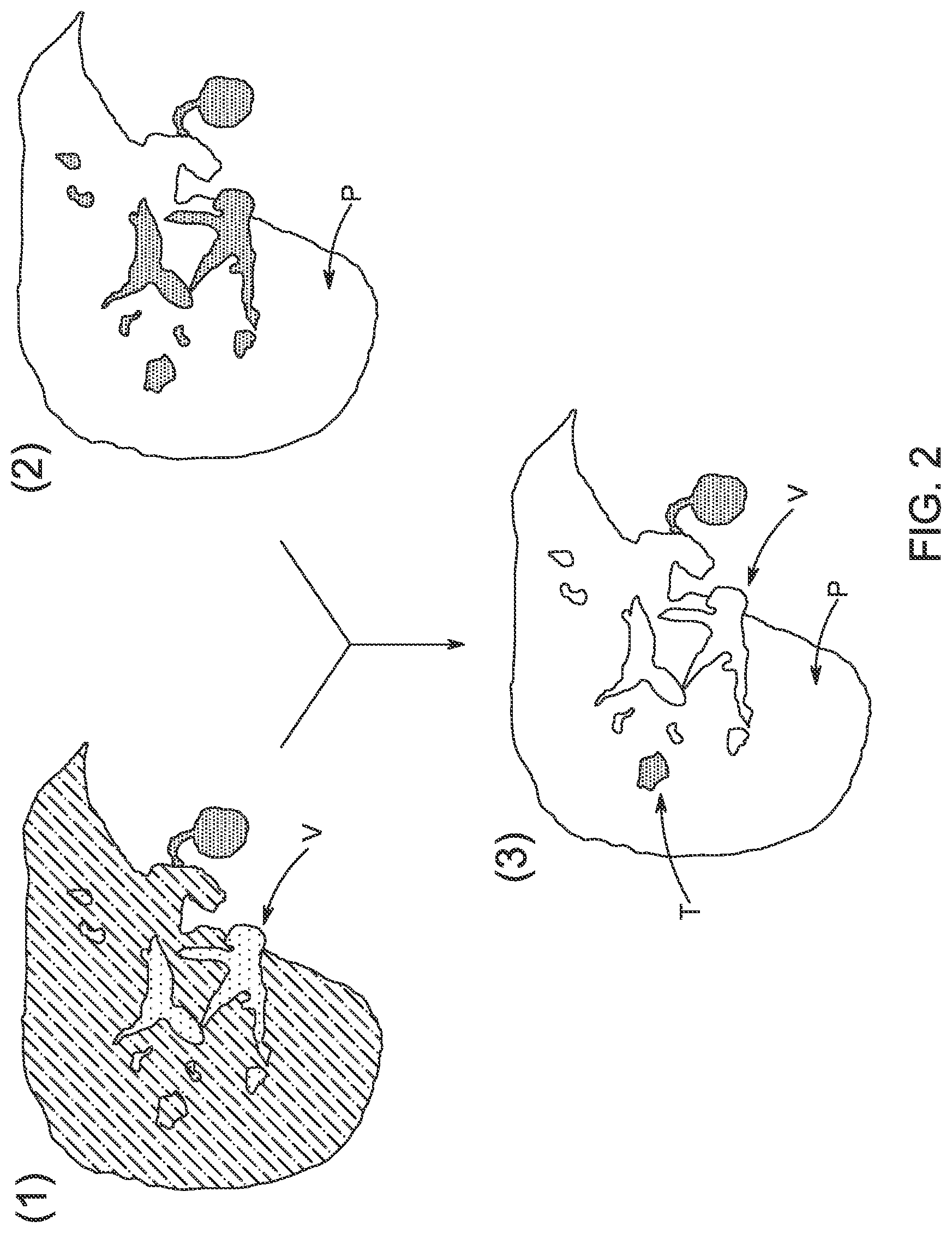 Patent US12310741 Figure 2 – Generation of MRI images of the liver