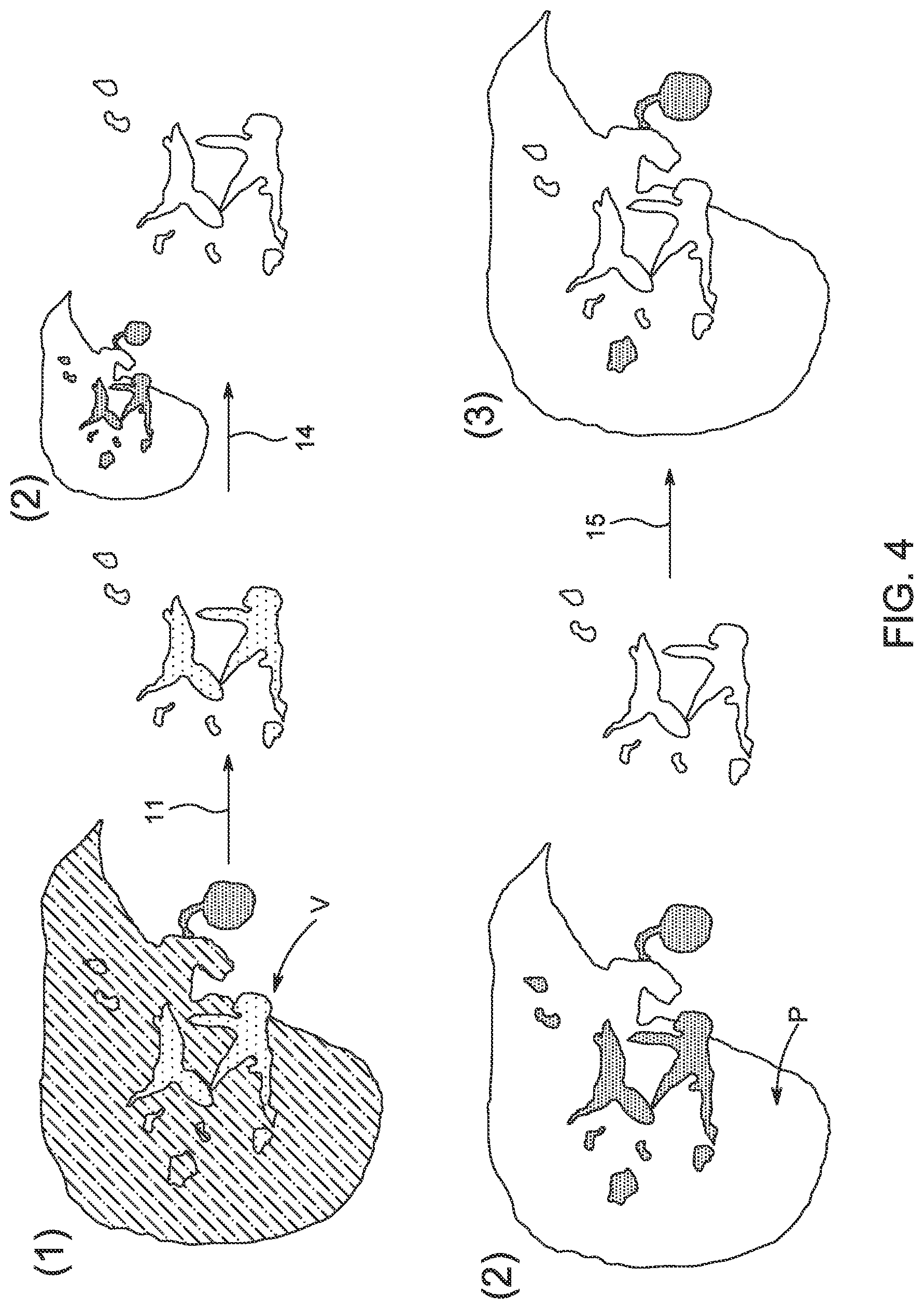 Patent US12310741 Figure 4 – Generation of MRI images of the liver