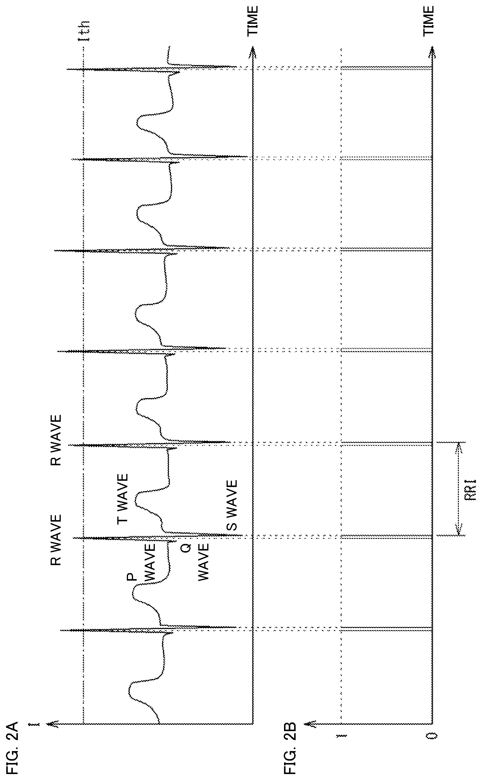 Patent US12310743 Figure 2 – Sleep apnea syndrome determination apparatus, sleep apnea syndrome determination method, and sleep apnea syndrome determination program