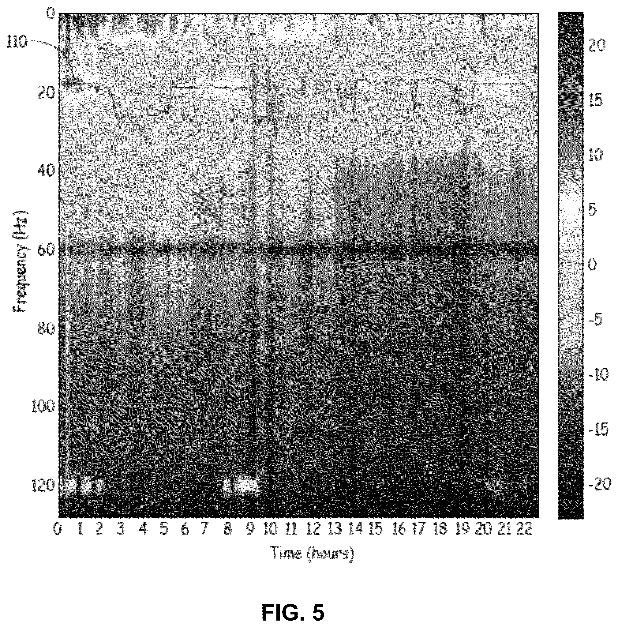 Patent US12310744 Figure 4 – Patient state determination based on one or more spectral characteristics of a bioelectrical brain signal