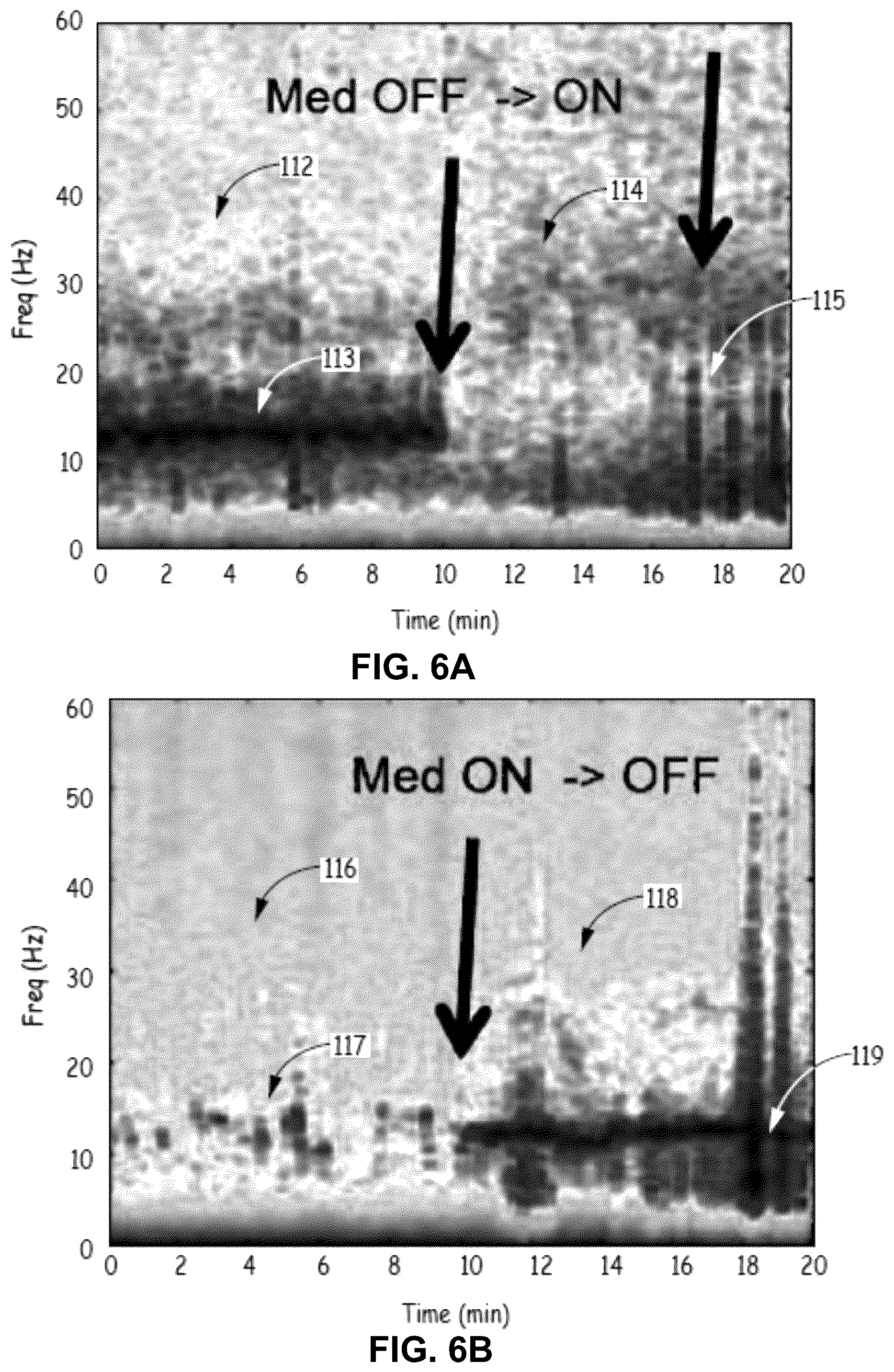 Patent US12310744 Figure 5 – Patient state determination based on one or more spectral characteristics of a bioelectrical brain signal