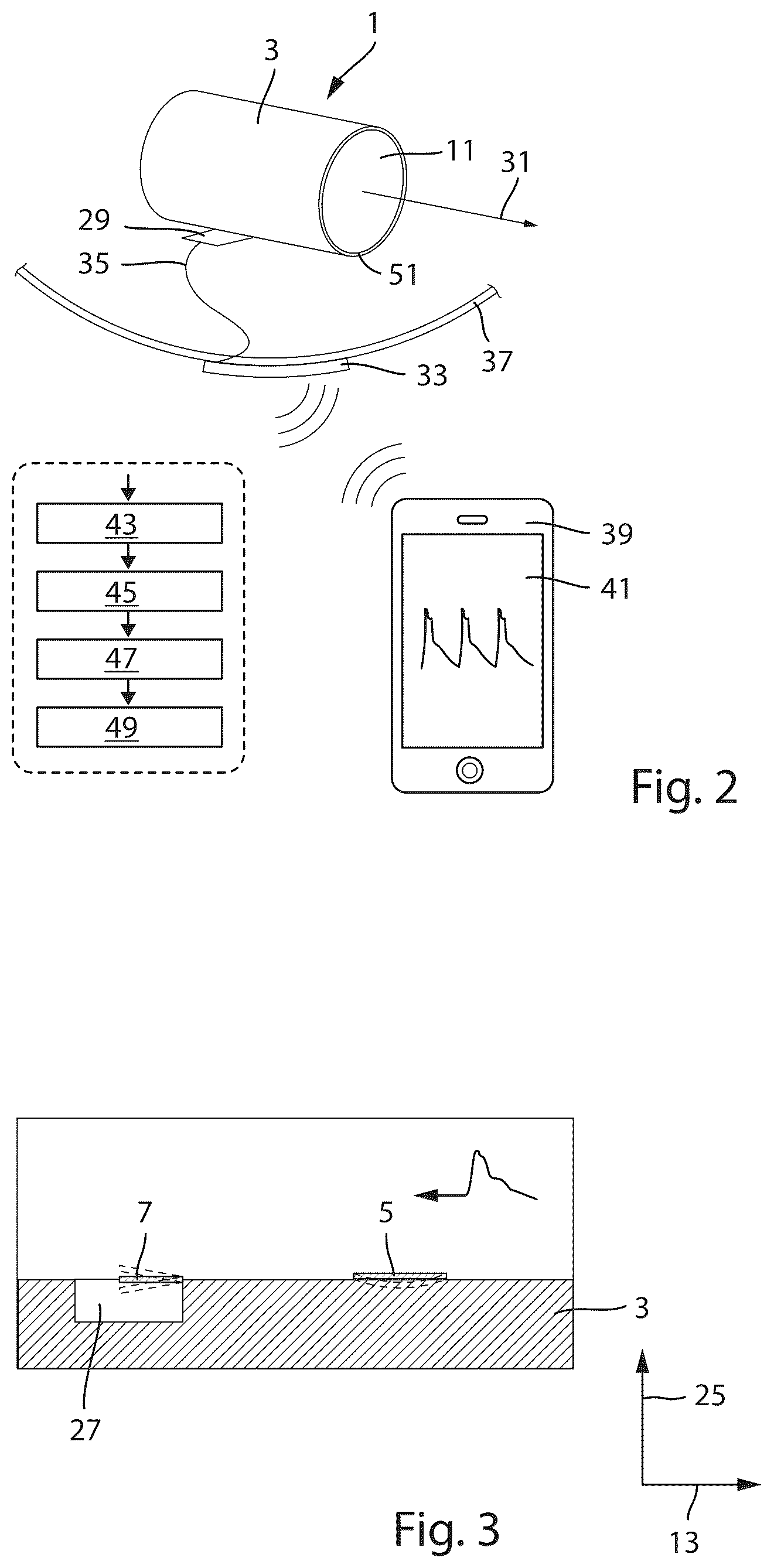 Patent US12310747 Figure 2 – Intelligent vascular graft