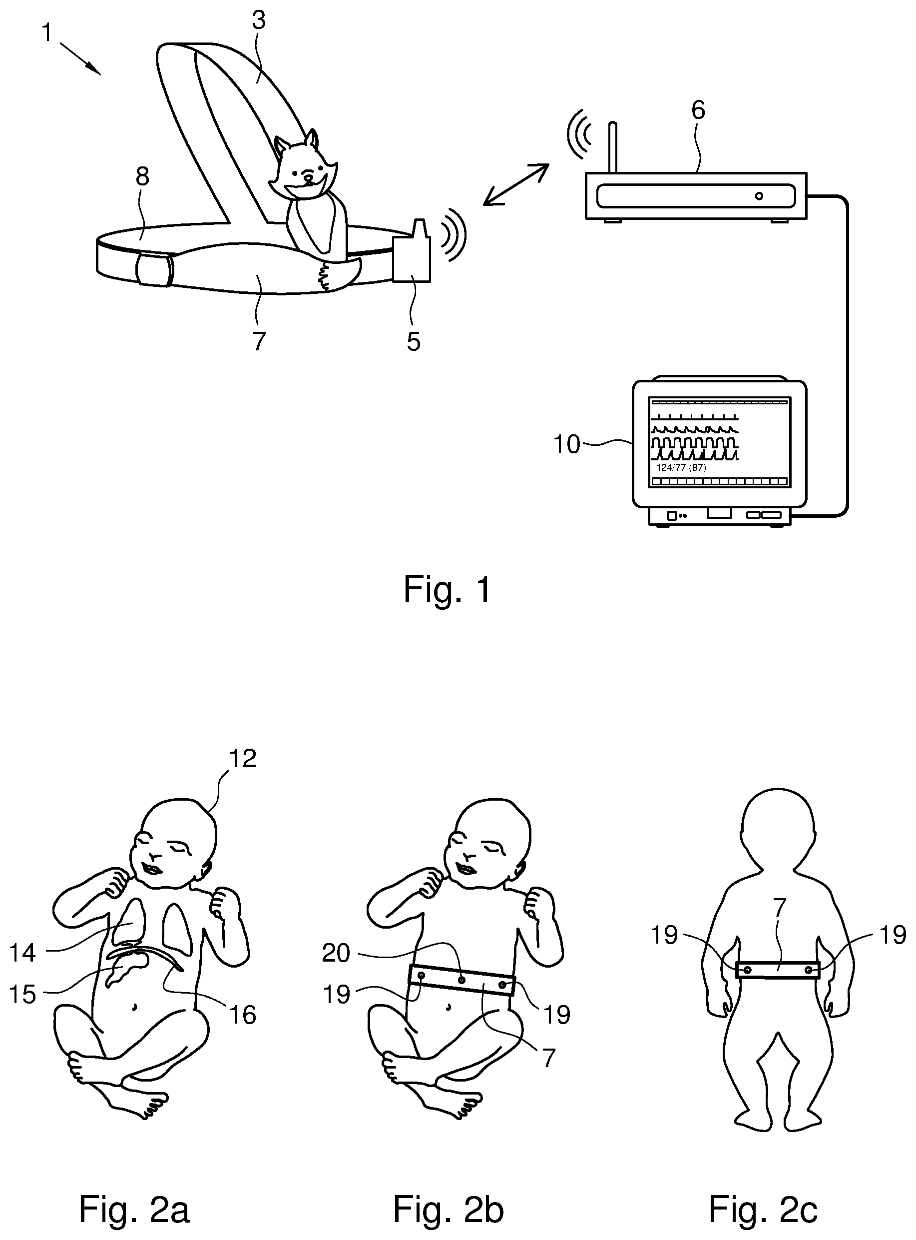 Patent US12310750 Figure 1 – Wearable device, method and system for monitoring one or more vital signs of a human body
