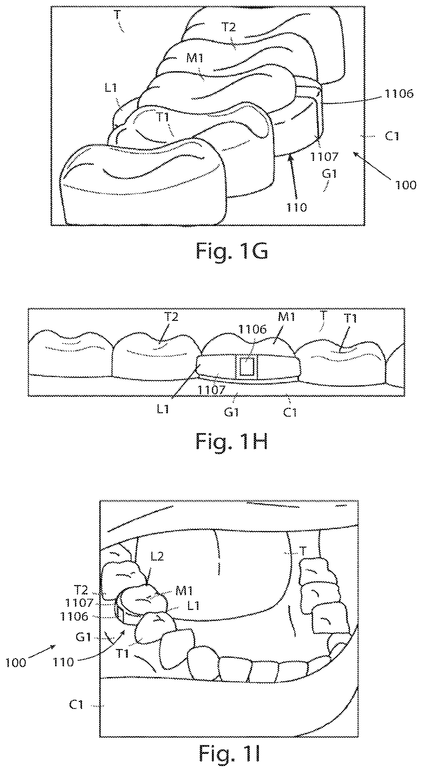 Patent US12310752 Figure 5 – Systems for measuring patient physiologic parameters