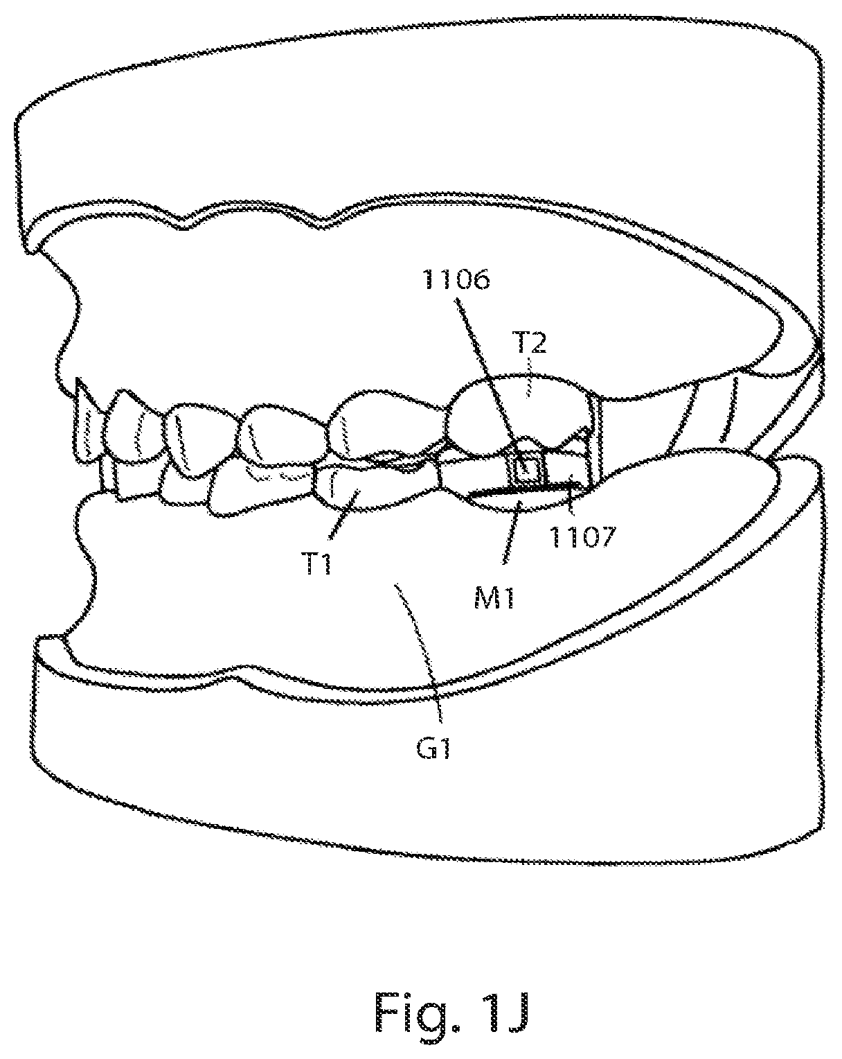 Patent US12310752 Figure 6 – Systems for measuring patient physiologic parameters