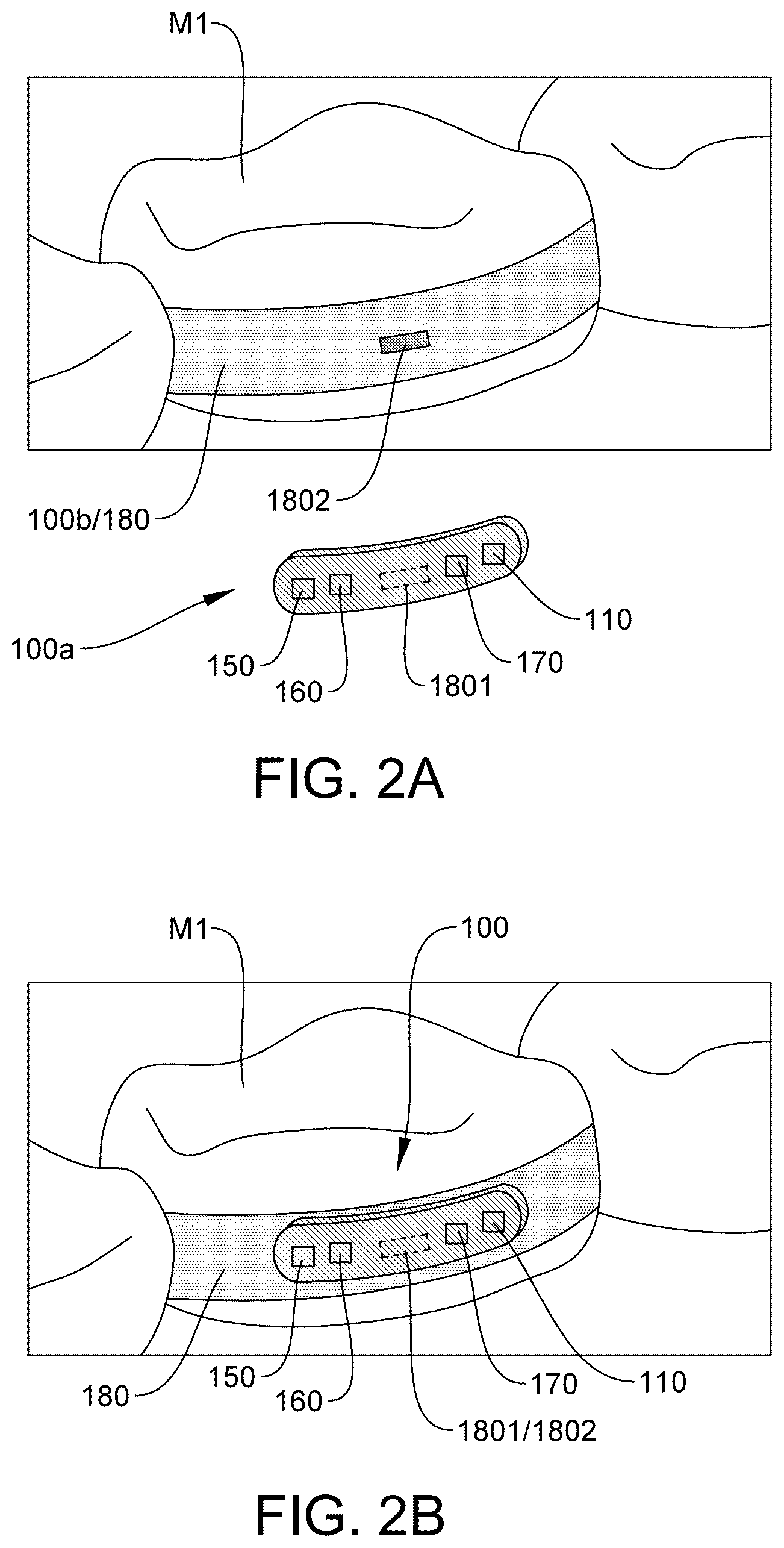 Patent US12310752 Figure 14 – Systems for measuring patient physiologic parameters