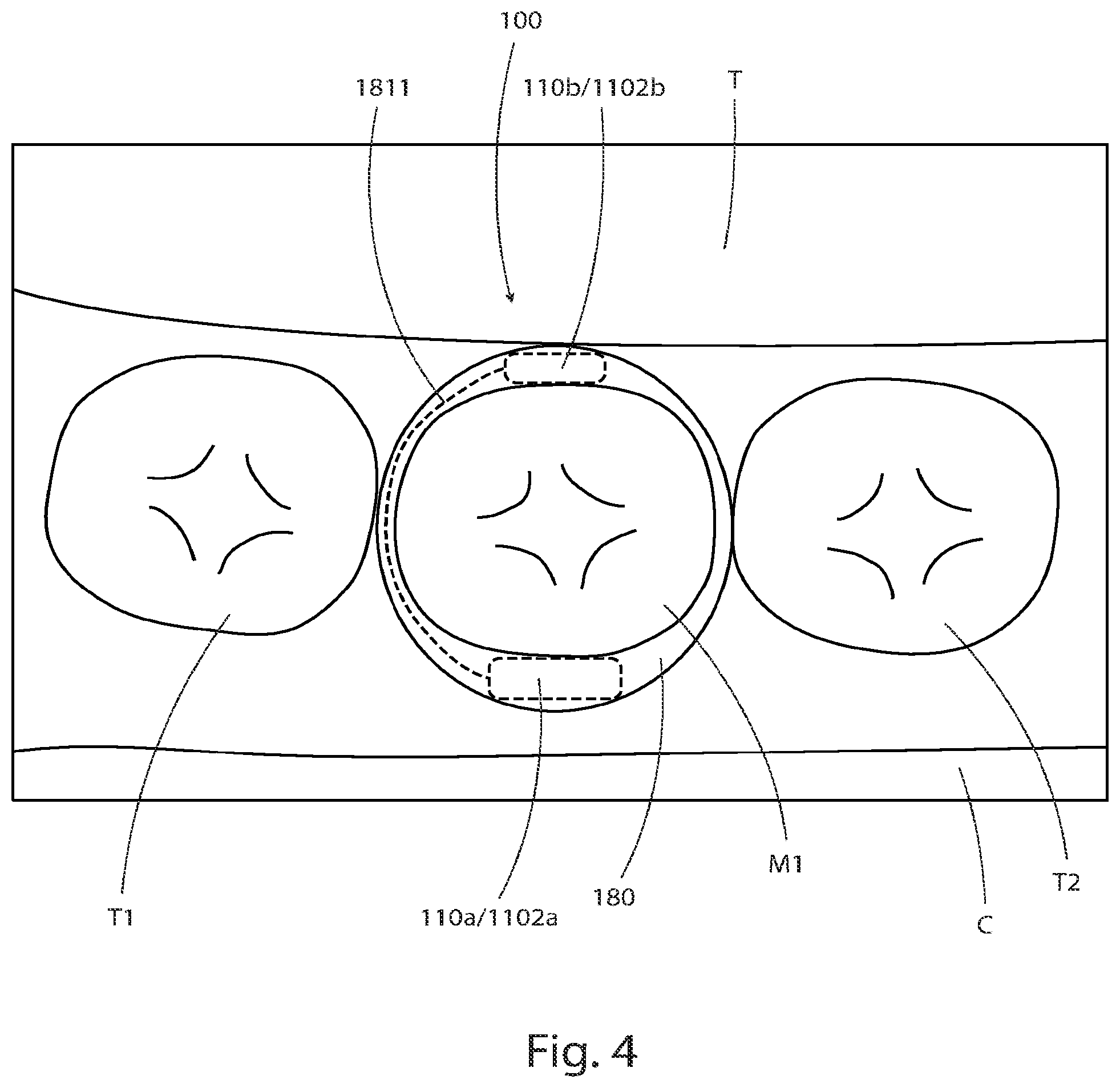 Patent US12310752 Figure 16 – Systems for measuring patient physiologic parameters