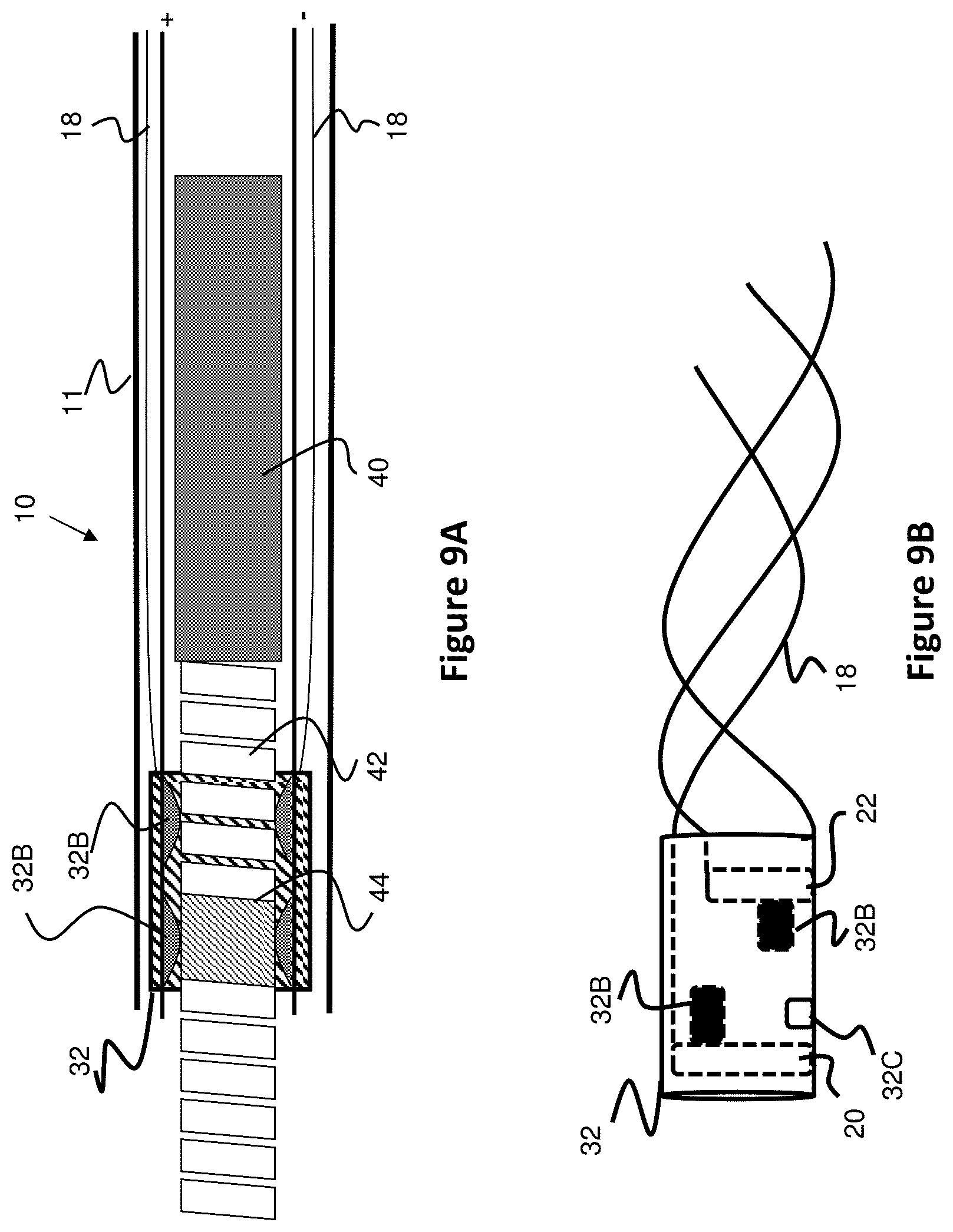 Patent US12310754 Figure 9 – Catheter circuit