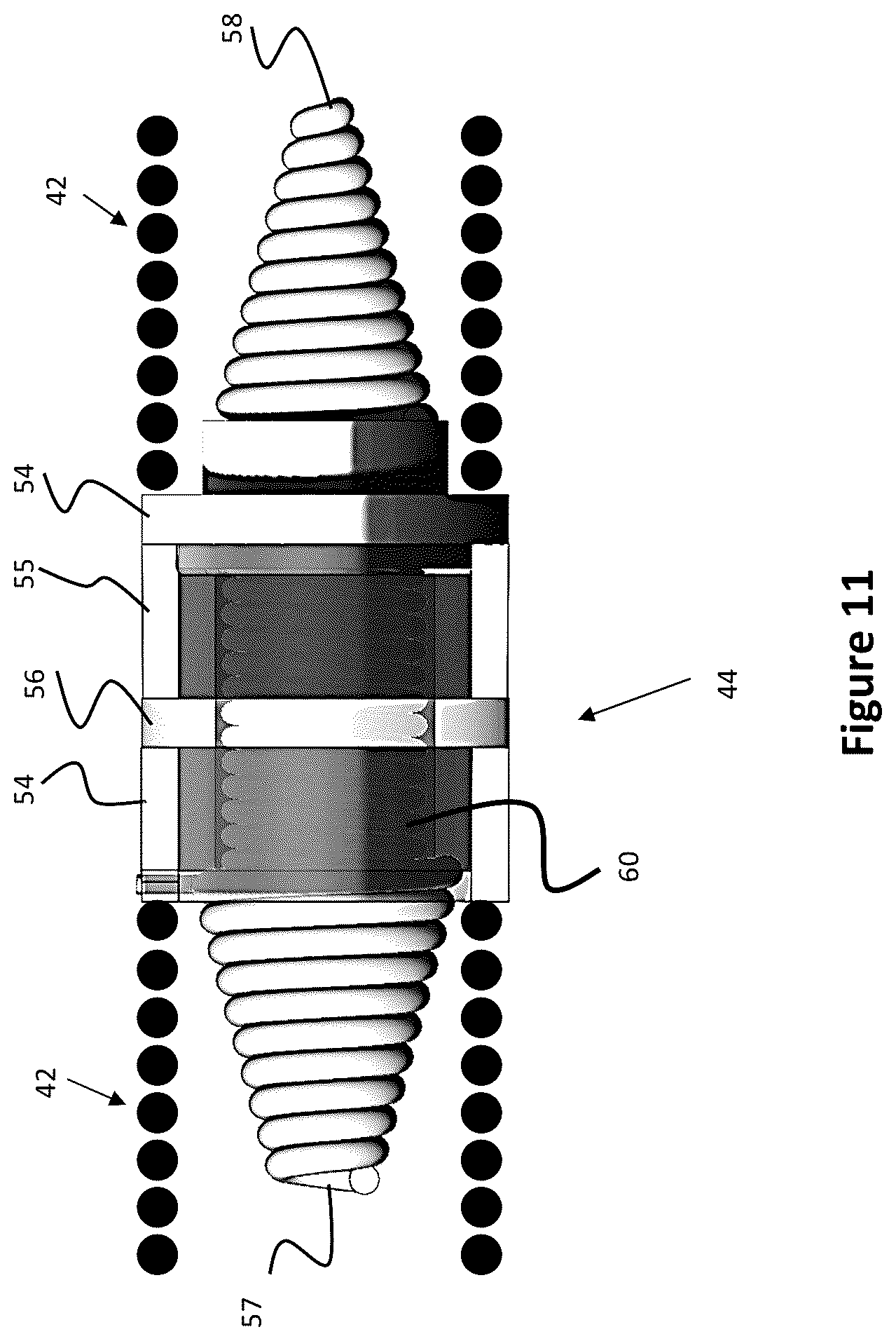 Patent US12310754 Figure 11 – Catheter circuit