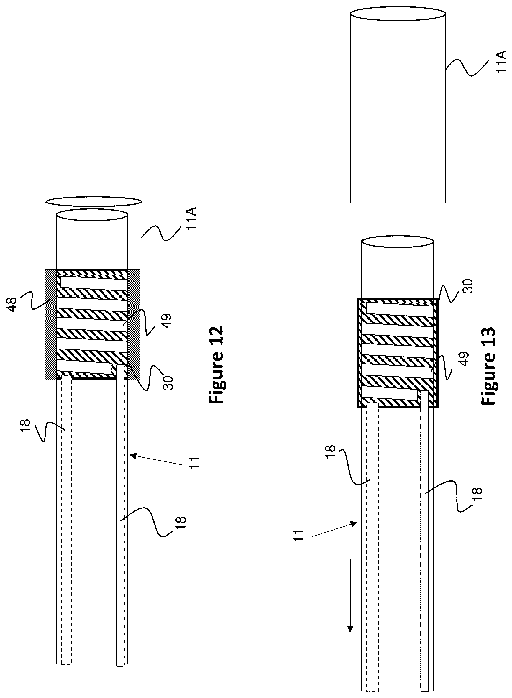 Patent US12310754 Figure 12 – Catheter circuit
