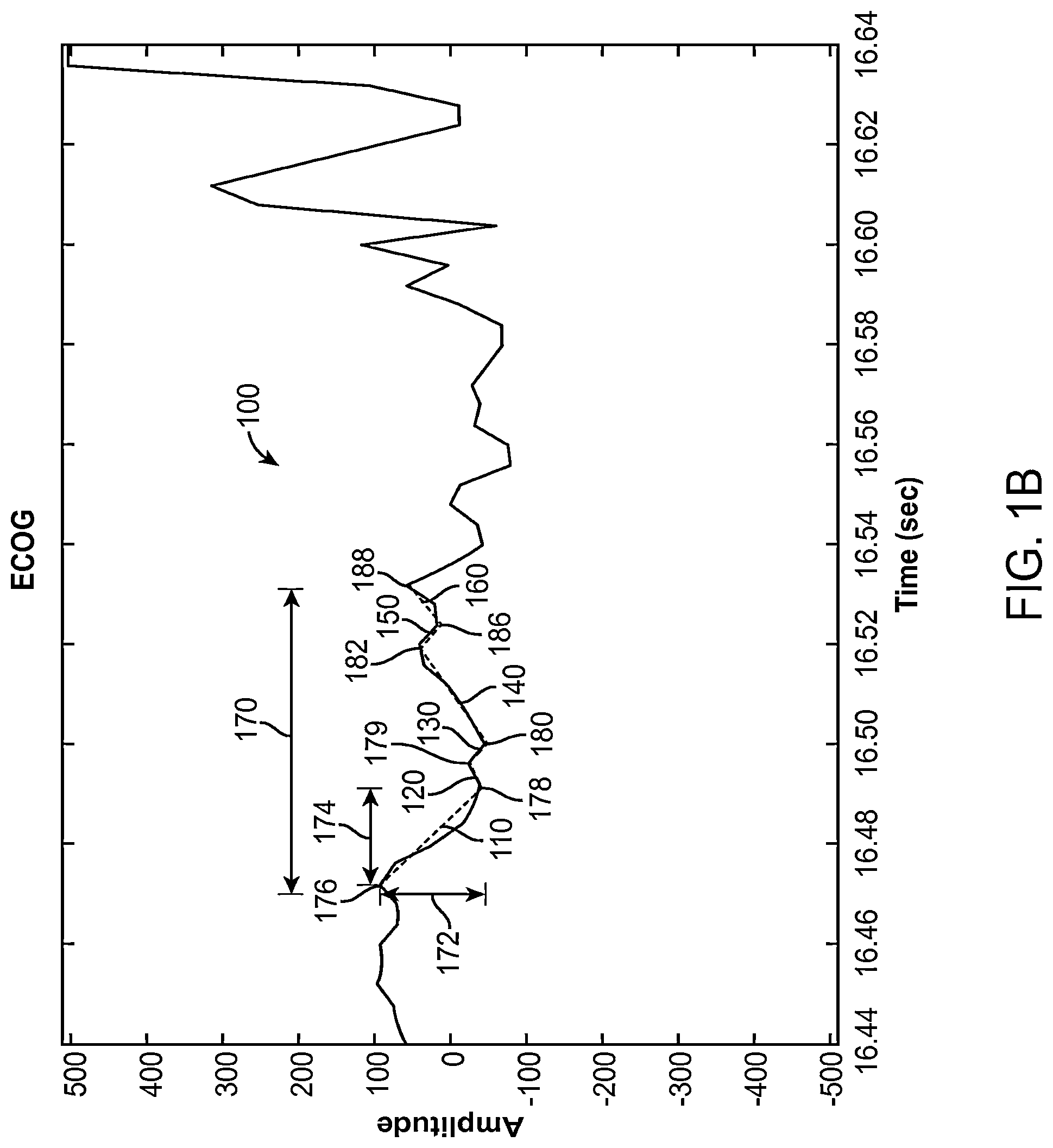 Patent US12310755 Figure 2 – Methods and systems for automatically identifying detection parameters for an implantable medical device