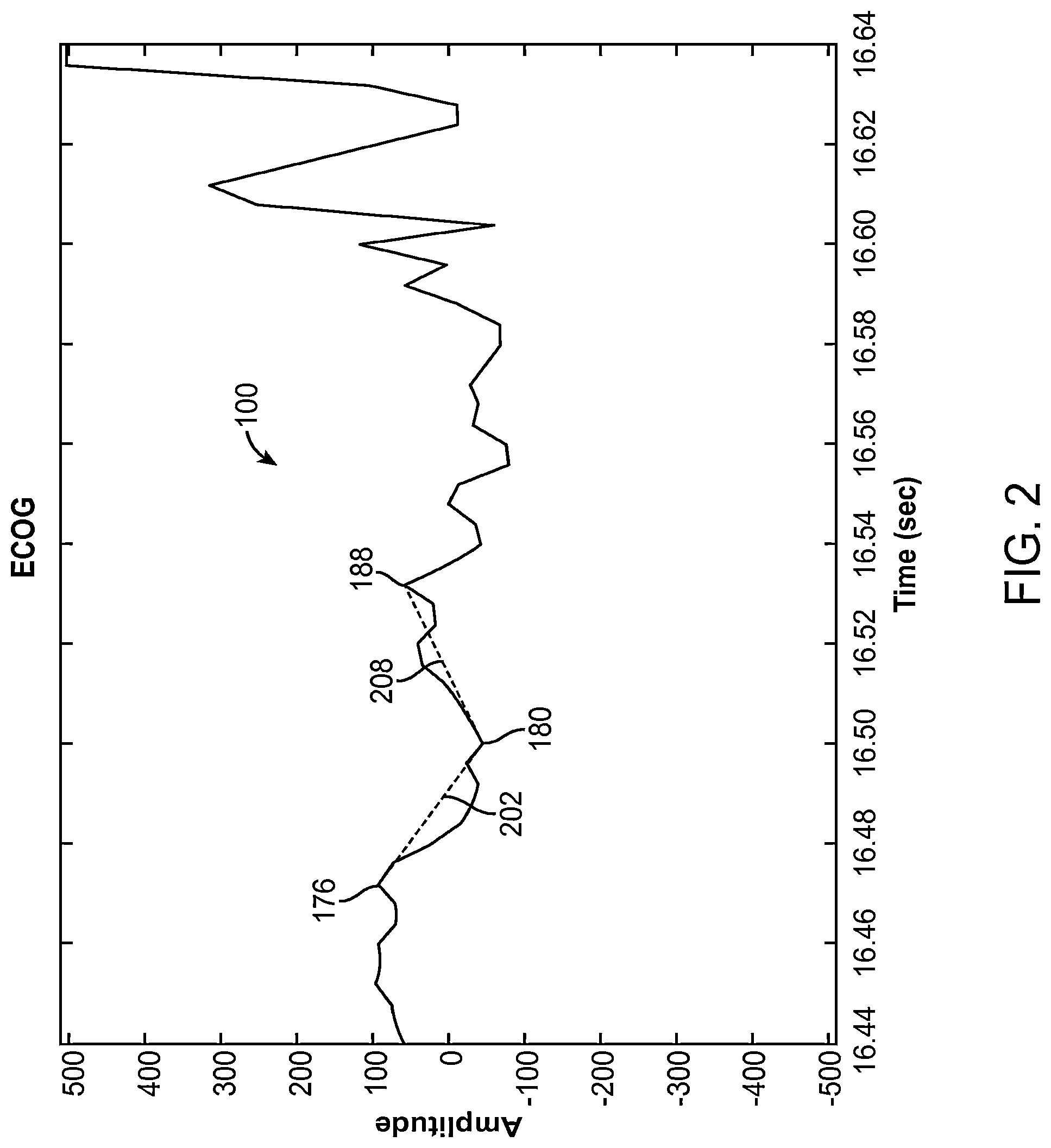 Patent US12310755 Figure 3 – Methods and systems for automatically identifying detection parameters for an implantable medical device