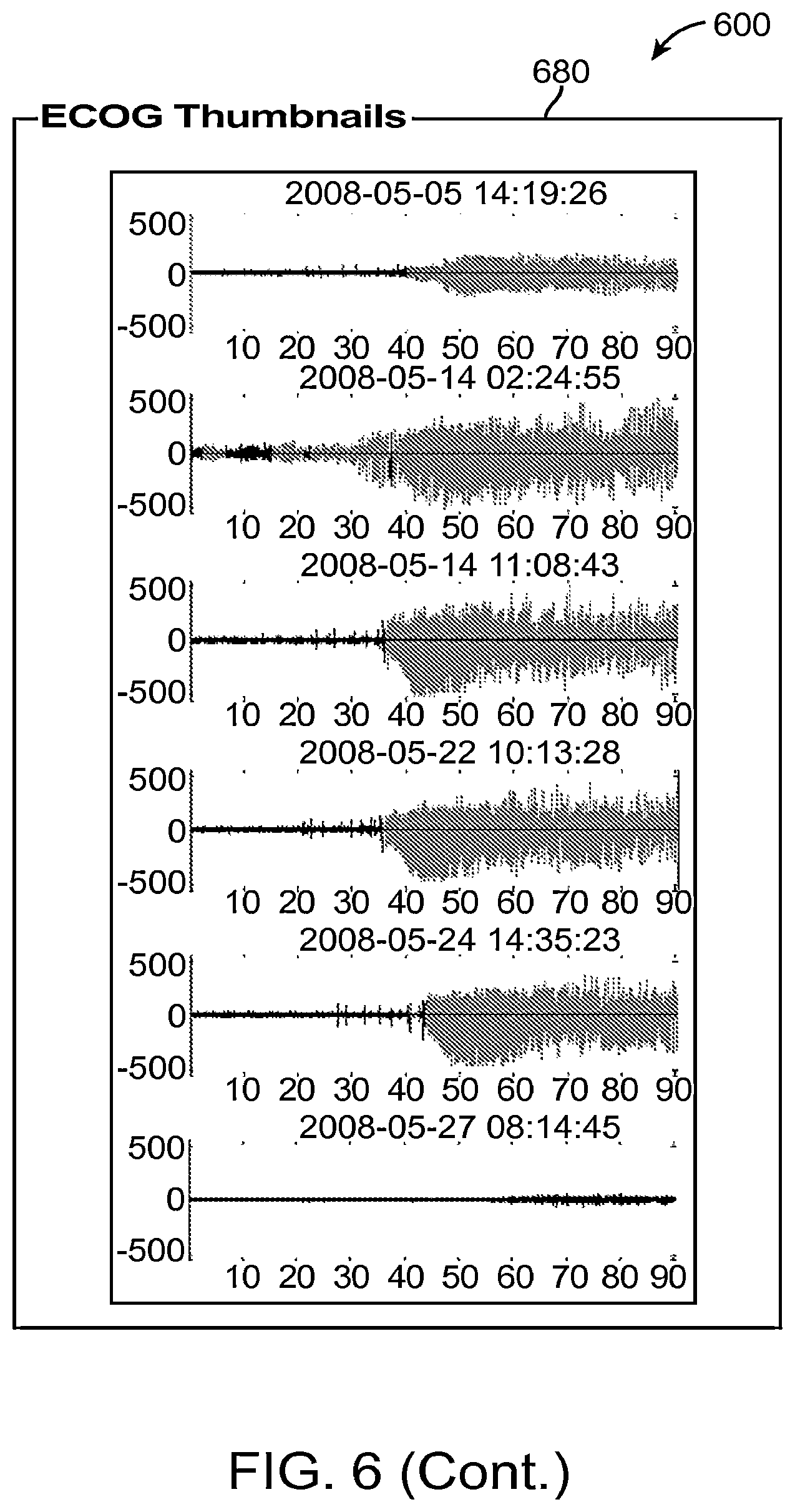 Patent US12310755 Figure 8 – Methods and systems for automatically identifying detection parameters for an implantable medical device