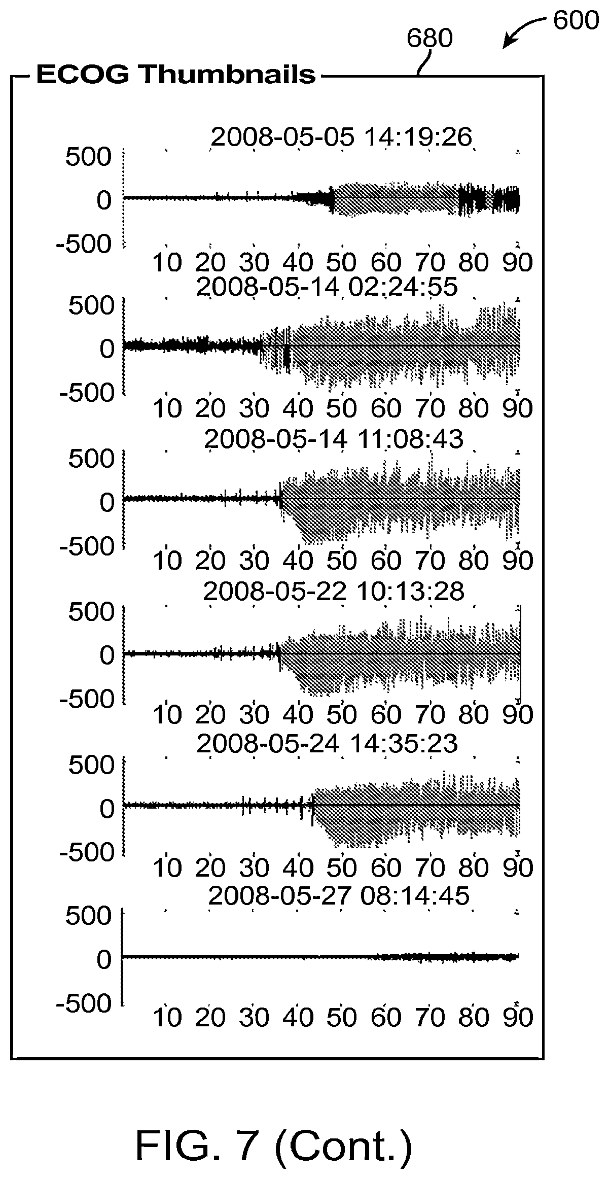Patent US12310755 Figure 10 – Methods and systems for automatically identifying detection parameters for an implantable medical device