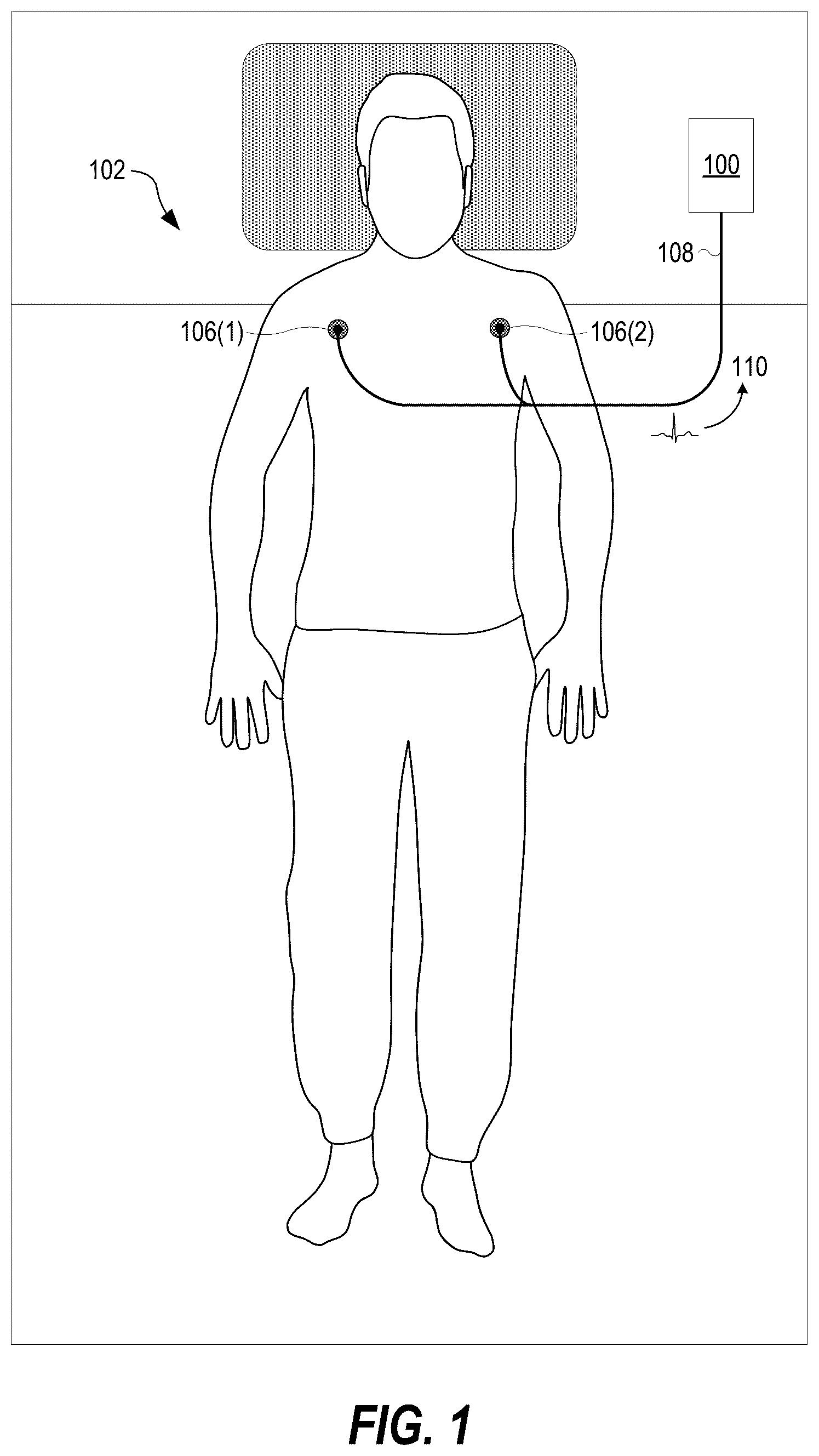 Patent US12310758 Figure 1 – Neural-network based electrocardiogramy monitor and associated methods