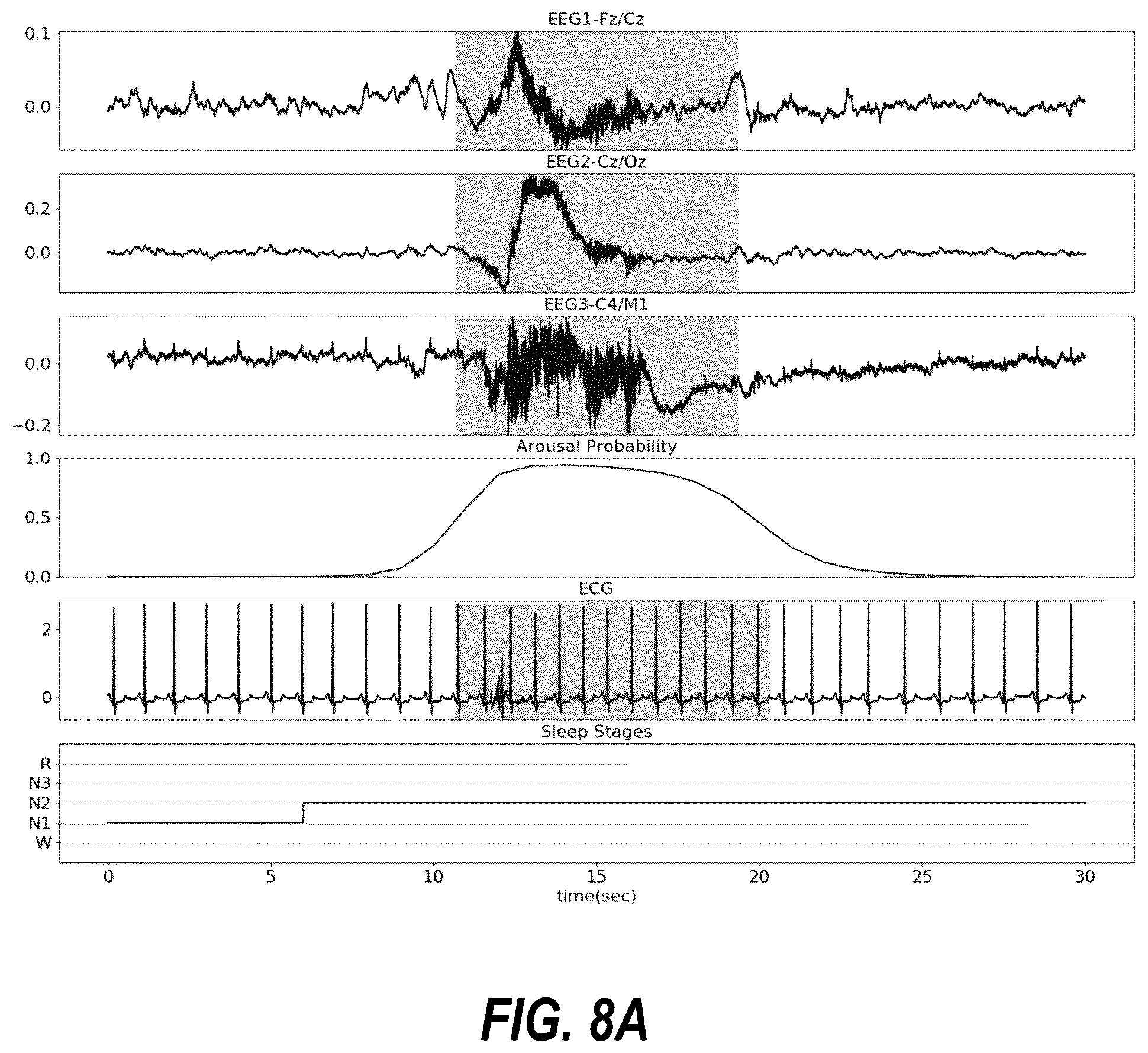 Patent US12310758 Figure 8 – Neural-network based electrocardiogramy monitor and associated methods