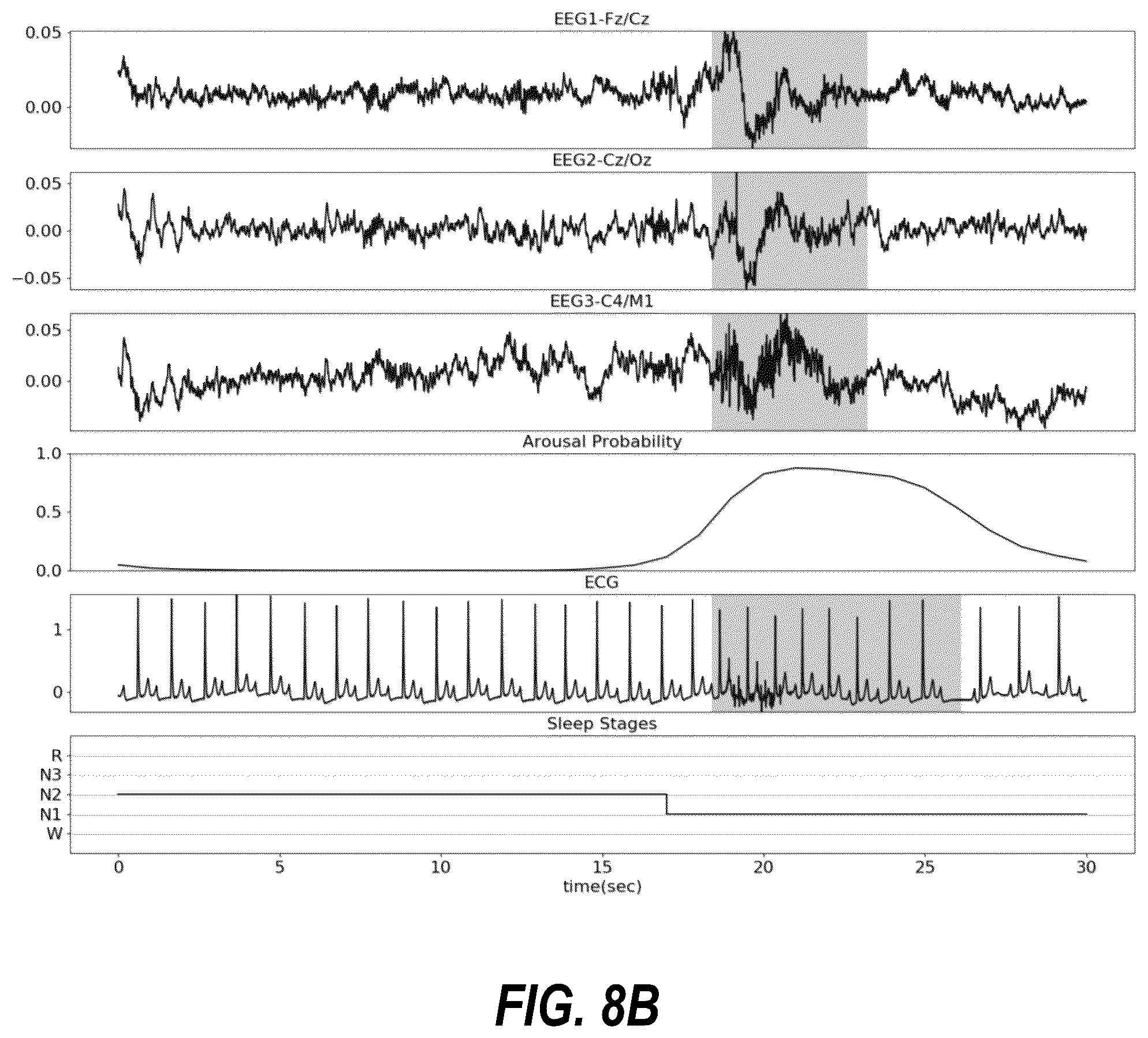 Patent US12310758 Figure 9 – Neural-network based electrocardiogramy monitor and associated methods