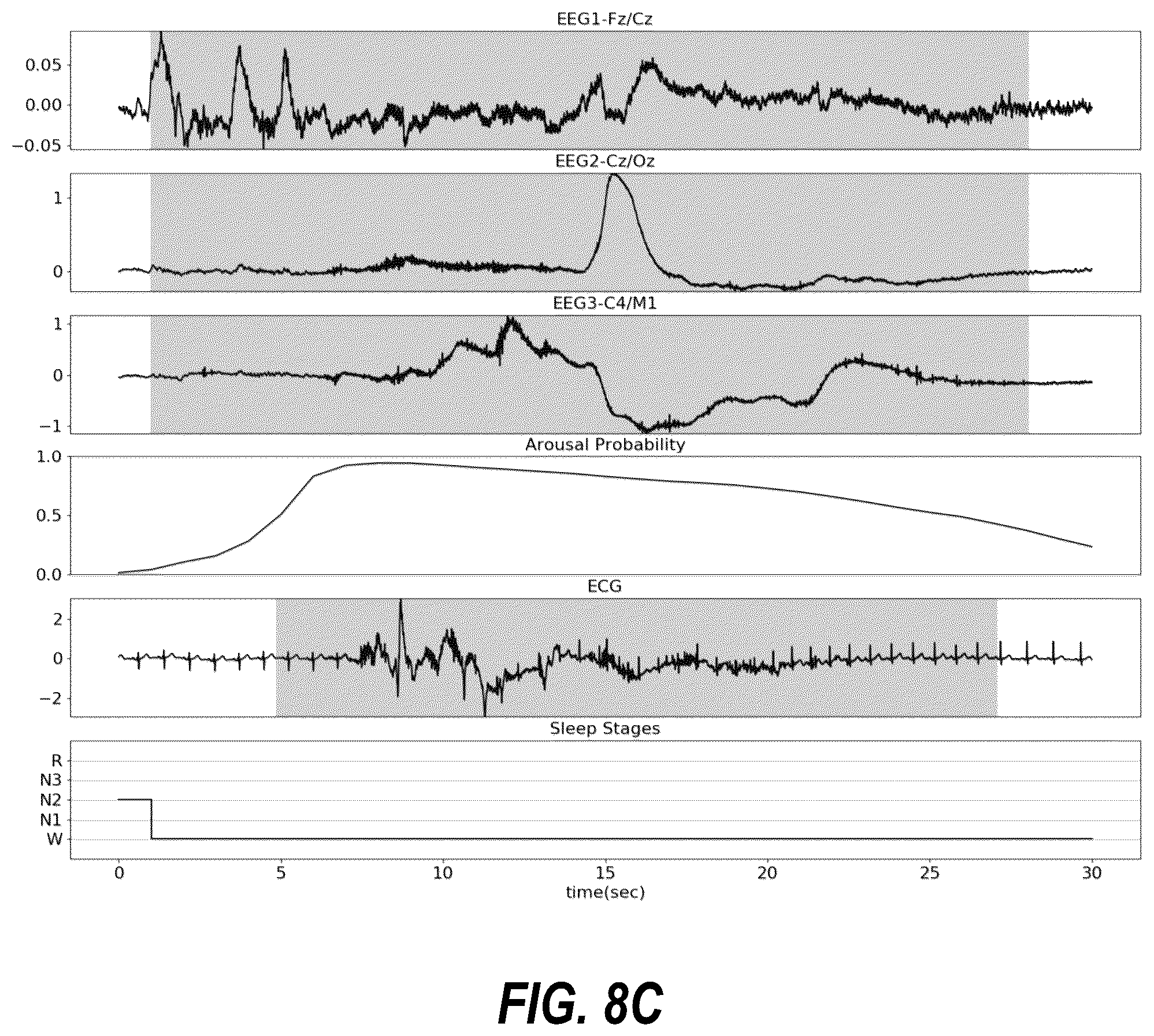 Patent US12310758 Figure 10 – Neural-network based electrocardiogramy monitor and associated methods