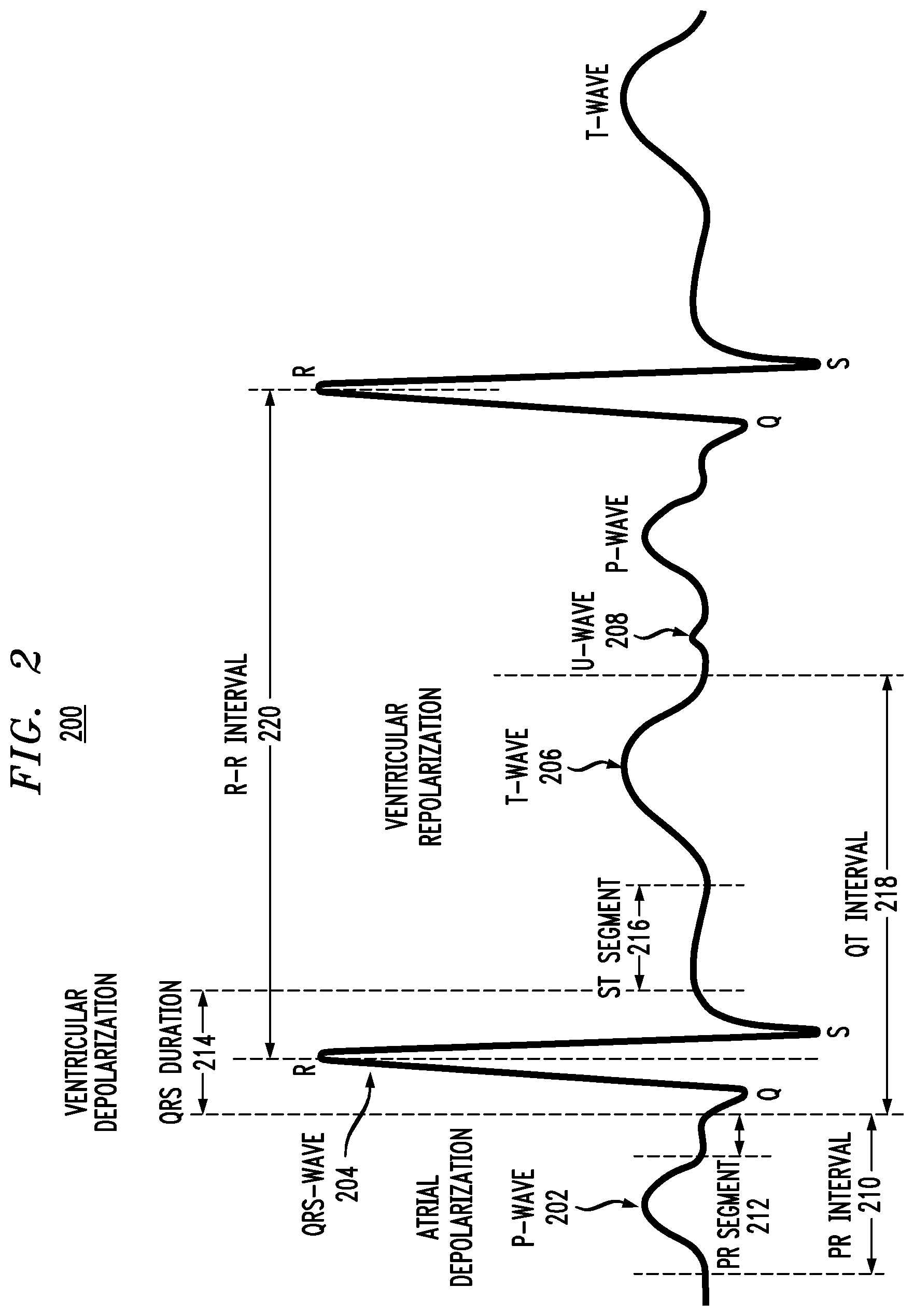 Patent US12310760 Figure 2 – Monitoring and processing physiological signals to detect and predict dysfunction of an anatomical feature of an individual