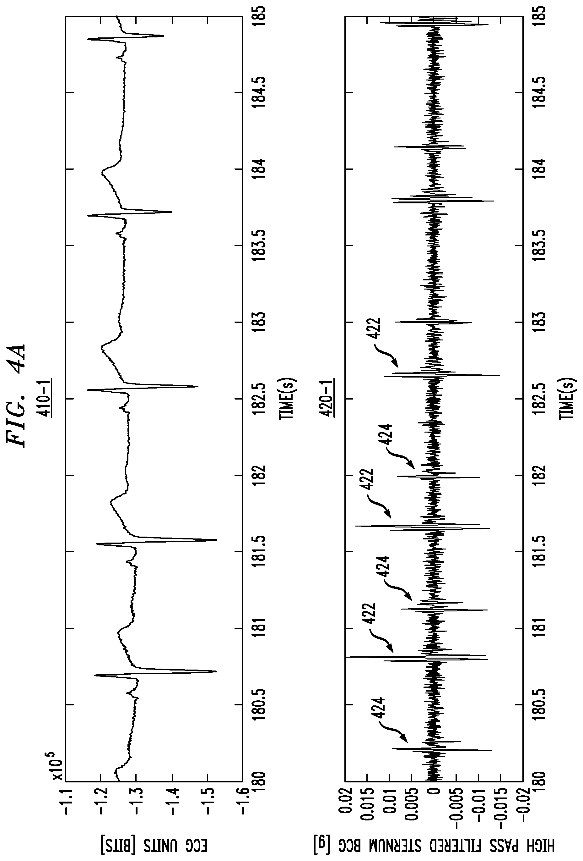 Patent US12310760 Figure 4 – Monitoring and processing physiological signals to detect and predict dysfunction of an anatomical feature of an individual