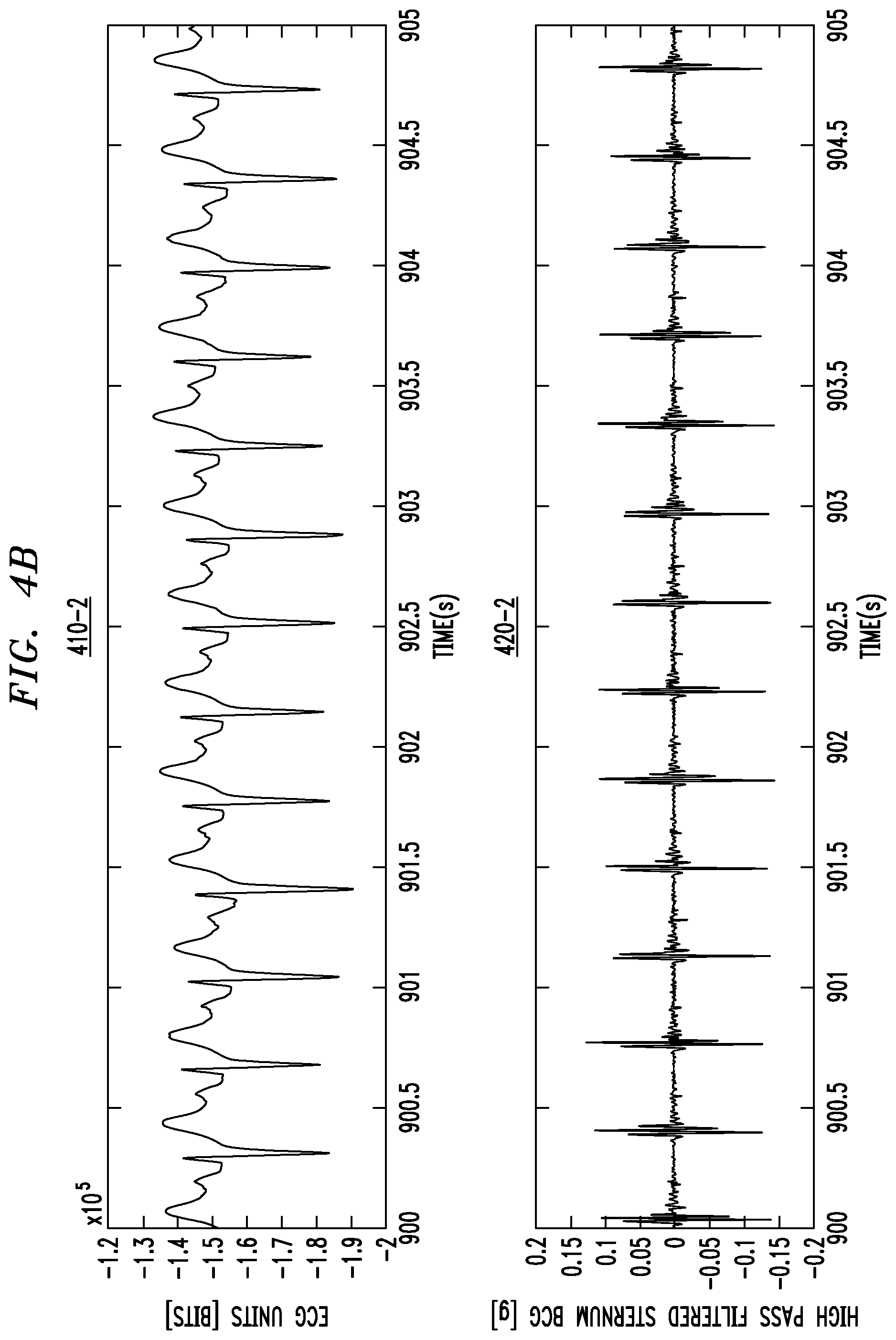 Patent US12310760 Figure 5 – Monitoring and processing physiological signals to detect and predict dysfunction of an anatomical feature of an individual